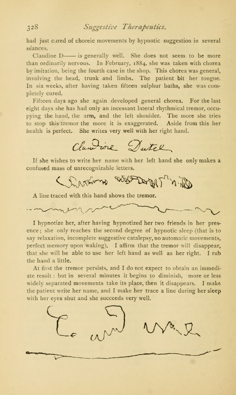 had just cured of choreic movements by hypnotic suggestion in several se'ances. Claudine D is generally well. She does not seem to be more than ordinarily nervous. In February, 18S4, she was taken with chorea by imitation, being the fourth case in the shop. This chorea was general, involving the head, trunk and limbs. The patient bit her tongue. In six weeks, after having taken fifteen sulphur baths, she was com- pletely cured. Fifteen days ago she again developed general chorea. For the last eight days she has had only an incessant lateral rhythmical tremor, occu- pying the hand, the arm, and the left shoulder. The more she tries to stop this tremor the more it is exaggerated. Aside from this her health is perfect. She writes very well with her right hand. If she wishes to write her name with her left hand she only makes a confused mass of unrecognizable letters. A line traced with this hand shows the tremor. •Xj I hypnotize her, after having hypnotized her two friends in her pres- ence ; she only reaches the second degree of hypnotic sleep (that is to say relaxation, incomplete suggestive catalepsy, no automatic movements, perfect memory upon waking). I affirm that the tremor will disappear, that she will be able to use her left hand as well as her right. I rub the hand a little. At first the tremor persists, and I do not expect to obtain an immedi- ate result : but in several minutes it begins to diminish, more or less widely separated movements take its place, then it disappears. I make the patient write her name, and I make her trace a line during her sleep with her eyes shut and she succeeds very well. r Y W\£