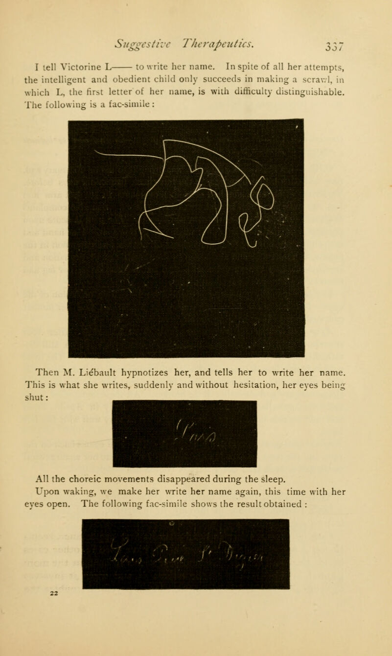 I tell Victorine L to write her name. In spite of all her attempts, the intelligent and obedient child only succeeds in making a scrawl, in which L, the first letter of her name, is with difficulty distinguishable. The following is a fac-simile : Then M. Liébault hypnotizes her, and tells her to write her name. This is what she writes, suddenly and without hesitation, her eyes being shut : All the choreic movements disappeared during the sleep. Upon waking, we make her write her name again, this time with her eyes open. The following fac-simile shows the result obtained :