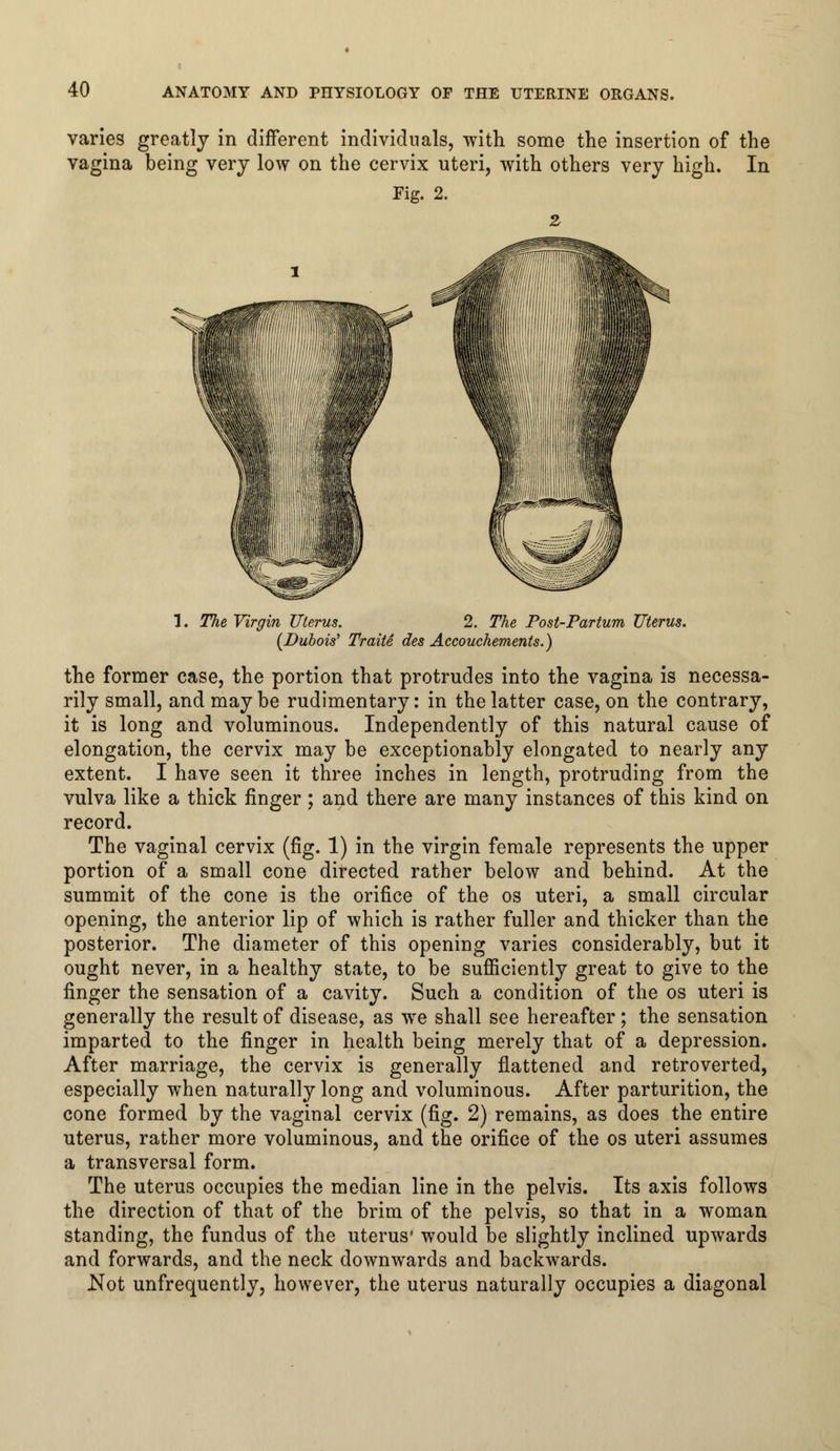 varies greatly in different individuals, with some the insertion of the vagina being very low on the cervix uteri, with others very high. In Fig. 2. 1. The Virgin Uterus. 2. The Post-Partum Uterus. (Dubois' Traite des Accouchements.) the former case, the portion that protrudes into the vagina is necessa- rily small, and may be rudimentary: in the latter case, on the contrary, it is long and voluminous. Independently of this natural cause of elongation, the cervix may be exceptionably elongated to nearly any extent. I have seen it three inches in length, protruding from the vulva like a thick finger ; and there are many instances of this kind on record. The vaginal cervix (fig. 1) in the virgin female represents the upper portion of a small cone directed rather below and behind. At the summit of the cone is the orifice of the os uteri, a small circular opening, the anterior lip of which is rather fuller and thicker than the posterior. The diameter of this opening varies considerably, but it ought never, in a healthy state, to be sufficiently great to give to the finger the sensation of a cavity. Such a condition of the os uteri is generally the result of disease, as we shall see hereafter; the sensation imparted to the finger in health being merely that of a depression. After marriage, the cervix is generally flattened and retroverted, especially when naturally long and voluminous. After parturition, the cone formed by the vaginal cervix (fig. 2) remains, as does the entire uterus, rather more voluminous, and the orifice of the os uteri assumes a transversal form. The uterus occupies the median line in the pelvis. Its axis follows the direction of that of the brim of the pelvis, so that in a woman standing, the fundus of the uterus' would be slightly inclined upwards and forwards, and the neck downwards and backwards. Not unfrequently, however, the uterus naturally occupies a diagonal