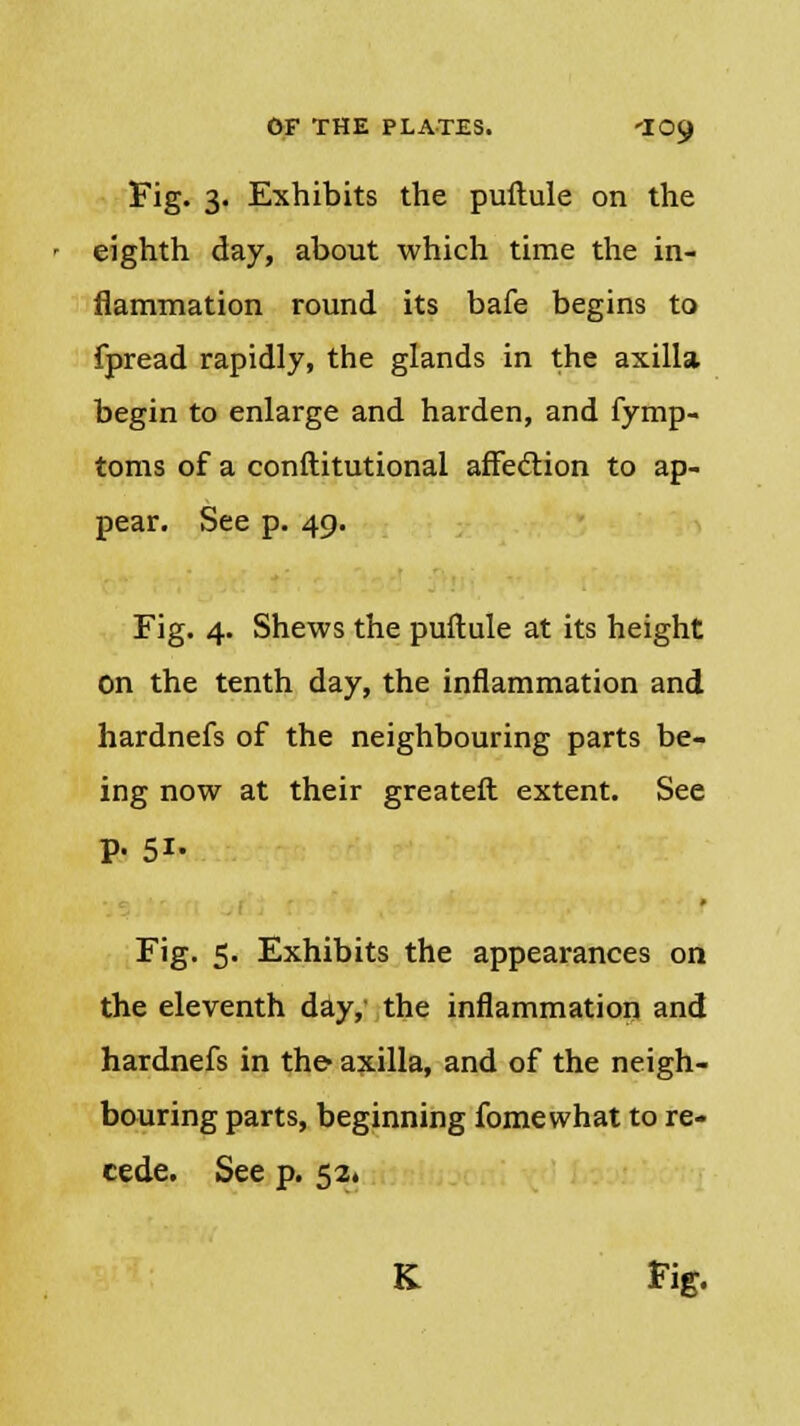Fig. 3. Exhibits the puftule on the eighth day, about which time the in- flammation round its bafe begins to fpread rapidly, the glands in the axilla begin to enlarge and harden, and fymp- toms of a conftitutional affection to ap- pear. See p. 49. Fig. 4. Shews the puftule at its height On the tenth day, the inflammation and hardnefs of the neighbouring parts be- ing now at their greateft extent. See P- 5i- # Fig. 5. Exhibits the appearances on the eleventh day, the inflammation and hardnefs in the axilla, and of the neigh- bouring parts, beginning fomewhat to re- cede. See p. 52. K. Fig.
