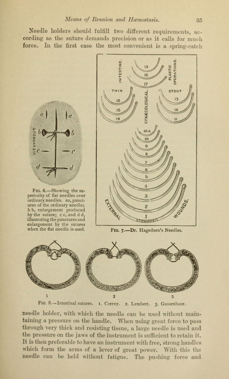 Needle holders should fulfill two different requirement-, ac- cording as the suture demands precision or as it calls for much force. In the first case the most convenient is a spring-catch p#^ ^%h 2 *c o —c </2L ™-</ FlG. 6.—Showing the su- periority of flat needles over ordinary needles, aa, punct- ures of the ordinary needle; b b, enlargement produced by the suture; cc, anddd, illustrating the punctures and enlargement by the sutures when the flat needle is used. FlG. 7.—Dr. Hagedorn's Needles. Fig. 8.—Intestinal sutures Lembert. 3. Gussenbaur. needle holder, with which the needle can be used without main- taining a pressure on the handle. When using great force to pass through very thick and resisting tissue, a large needle is used and the pressure on the jaws of the instrument is sufficient to retain it. It is then preferable to have an instrument with free, strong handles which form the arms of a lever of great power. With this the needle can be held without fatigue. The pushing force and