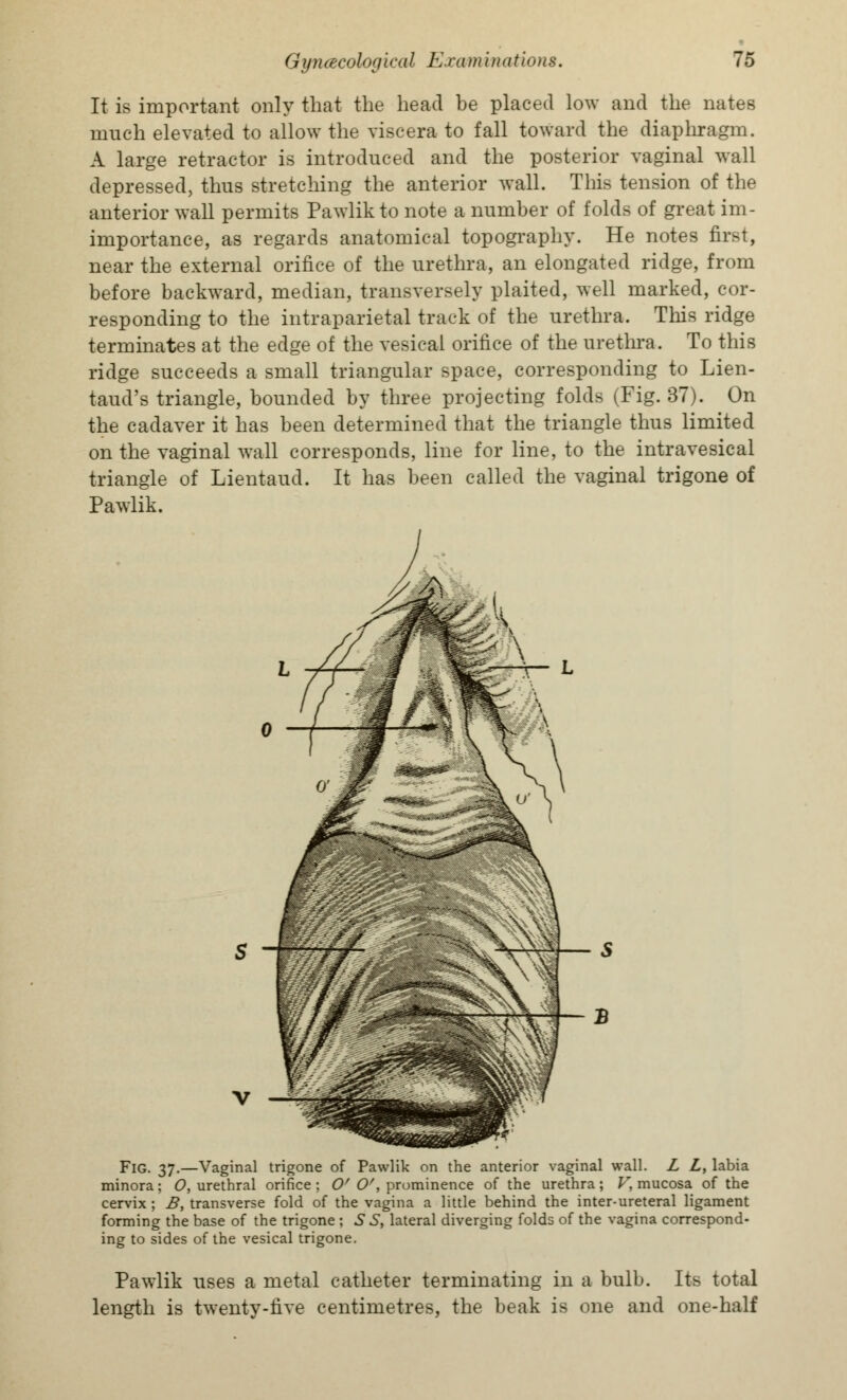 It is important only that the head be placed low and the nates much elevated to allow the viscera to fall toward the diaphragm. A large retractor is introduced and the posterior vaginal wall depressed, thus stretching the anterior wall. This tension of the anterior wall permits Pawlikto note a number of folds of great im- importance, as regards anatomical topography. He notes first, near the external orifice of the urethra, an elongated ridge, from before backward, median, transversely plaited, well marked, cor- responding to the intraparietal track of the urethra. This ridge terminates at the edge of the vesical orifice of the urethra. To this ridge succeeds a small triangular space, corresponding to Lien- taud's triangle, bounded by three projecting folds (Fig. 37). On the cadaver it has been determined that the triangle thus limited on the vaginal wall corresponds, line for line, to the intravesical triangle of Lientaud. It has been called the vaginal trigone of Pawlik. Fig. 37.—Vaginal trigone of Pawlik on the anterior vaginal wall. L L, labia minora; O, urethral orifice; Of O', prominence of the urethra; V, mucosa of the cervix ; B, transverse fold of the vagina a little behind the inter-ureteral ligament forming the base of the trigone ; S S, lateral diverging folds of the vagina correspond- ing to sides of the vesical trigone. Pawlik uses a metal catheter terminating in a bulb. Its total length is twenty-five centimetres, the beak is one and one-half