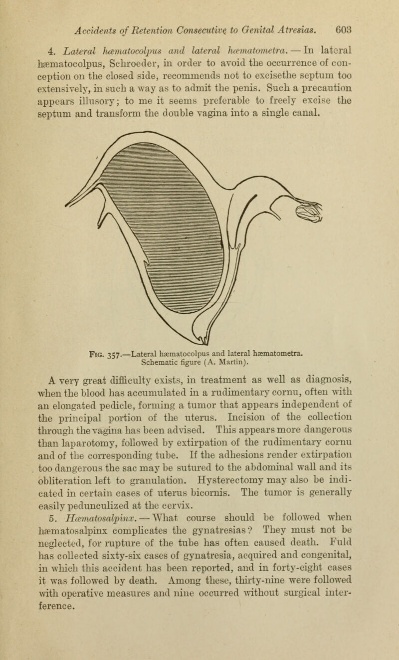 4. Lateral hamatocolpus and lateral hamatometra, — In lateral h# ma toe olpus, Schroeder, in order to avoid the occurrence of con- ception on the closed side, recommends not to excisethe septum too extensively, in such a way as to admit the penis. Such a precaution appears illusory; to me it seems preferable to freely excise the septum and transform the double vagina into a single canal. Fig. 357.—Lateral haematocolpus and lateral haematometra. Schematic figure (A. Martin). A very great difficulty exists, in treatment as well as diagnosis, when the blood has accumulated in a rudimentary cornu, often with an elongated pedicle, forming a tumor that appears independent of the principal portion of the uterus. Incision of the collection through the vagina has been advised. This appears more dangerous than laparotomy, followed by extirpation of the rudimentary cornu and of the corresponding tube. If the adhesions render extirpation too dangerous the sac may be sutured to the abdominal wall and its obliteration left to granulation. Hysterectomy may also be indi- cated in certain cases of uterus bicornis. The tumor is generally easily peduncnlized at the cervix. 5. Jhematosalpinr. — What course should be followed when hematosalpinx complicates the gynatresias ? They must not be neglected, for rupture of the tube has often caused death. Fuld has collected sixty-six cases of gynatresia, acquired and congenital, in which this accident has been reported, and in forty-eight cases it was followed by death. Among these, thirty-nine were followed with operative measures and nine occurred without surgical inter- ference.