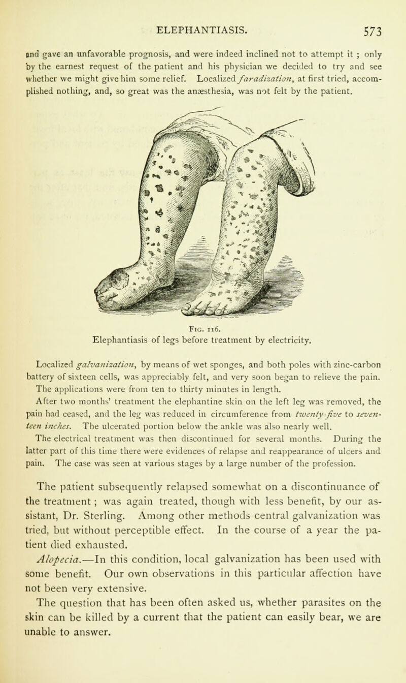 una gave an unfavorable prognosis, and were indeed inclined not to attempt it ; only by the earnest request of the patient and his physician we decided to try and see whether we might give him some relief. Localized faradization, at first tried, accom- plished nothing, and, so great was the anaesthesia, was not felt by the patient. Fig. 116. Elephantiasis of legs before treatment by electricity. Localized galvanization, by means of wet sponges, and both poles with zinc-carbon battery of sixteen cells, was appreciably felt, and very soon began to relieve the pain. The applications were from ten to thirty minutes in length. After two months' treatment the elephantine skin on the left leg was removed, the pain had ceased, and the leg was reduced in circumference from twenty-five to seven- teen inches. The ulcerated portion below the ankle was also nearly well. The electrical treatment was then discontinued for several months. During the latter part of this time there were evidences of relapse and reappearance of ulcers and pain. The case was seen at various stages by a large number of the profession. The patient subsequently relapsed somewhat on a discontinuance of the treatment; was again treated, though with less benefit, by our as- sistant, Dr. Sterling. Among other methods central galvanization was tried, but without perceptible effect. In the course of a year the pa- tient died exhausted. Alopecia.—In this condition, local galvanization has been used with some benefit. Our own observations in this particular affection have not been very extensive. The question that has been often asked us, whether parasites on the skin can be killed by a current that the patient can easily bear, we are unable to answer.