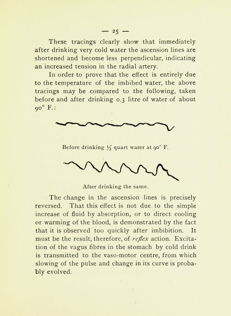 These tracings clearly show that immediately after drinking very cold water the ascension lines are shortened and become less perpendicular, indicating an increased tension in the radial artery. In order to prove that the effect is entirely due to the temperature of the imbibed water, the above tracings may be compared to the following, taken before and after drinking 0.3 litre of water of about 900 F.: Before drinking y$ quart water at 90° F. After drinking the same. The change in the ascension lines is precisely reversed. That this effect is not due to the simple increase of fluid by absorption, or to direct cooling or warming of the blood, is demonstrated by the fact that it is observed too quickly after imbibition. It must be the result, therefore, of reflex action. Excita- tion of the vagus fibres in the stomach by cold drink is transmitted to the vaso-motor centre, from which slowing of the pulse and change in its curve is proba- bly evolved.