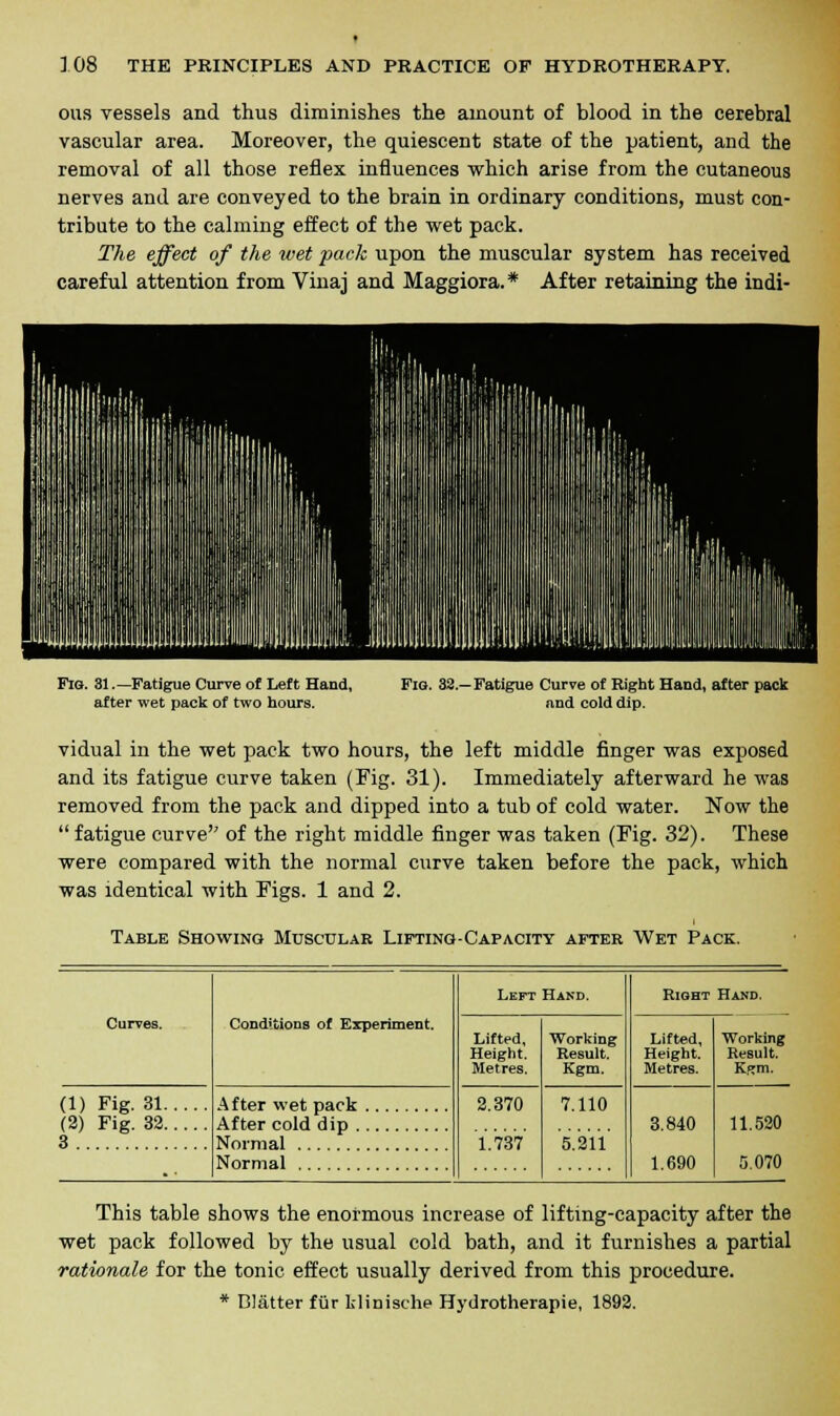 ous vessels and thus diminishes the amount of blood in the cerebral vascular area. Moreover, the quiescent state of the patient, and the removal of all those reflex influences which arise from the cutaneous nerves and are conveyed to the brain in ordinary conditions, must con- tribute to the calming effect of the wet pack. The effect of the wet pack upon the muscular system has received careful attention from Vinaj and Maggiora.* After retaining the indi- Fio. 31.—Fatigue Curve of Left Hand, after wet pack of two hours. Fio. 33.- Fatigue Curve of Right Hand, after pack and cold dip. vidual in the wet pack two hours, the left middle finger was exposed and its fatigue curve taken (Fig. 31). Immediately afterward he was removed from the pack and dipped into a tub of cold water. Now the  fatigue curve of the right middle finger was taken (Fig. 32). These were compared with the normal curve taken before the pack, which was identical with Figs. 1 and 2. Table Showing Muscular Lifting-Capacity after Wet Pack. Conditions of Experiment. Left Hand. Right Hand. Curves. Lifted, Height. Metres. Working Result. Kgm. Lifted, Height. Metres. Working li.sult. K>*m. (1) Fig. 31 (2) Fig. 32 3 After wet pack 2.370 1.737 7.110 5.211 3.840 1.690 After cold dip 11.520 Normal 5.070 This table shows the enormous increase of lifting-capacity after the wet pack followed by the usual cold bath, and it furnishes a partial rationale for the tonic effect usually derived from this procedure. * Blatter fur Lliuische Hydrotherapie, 1892.
