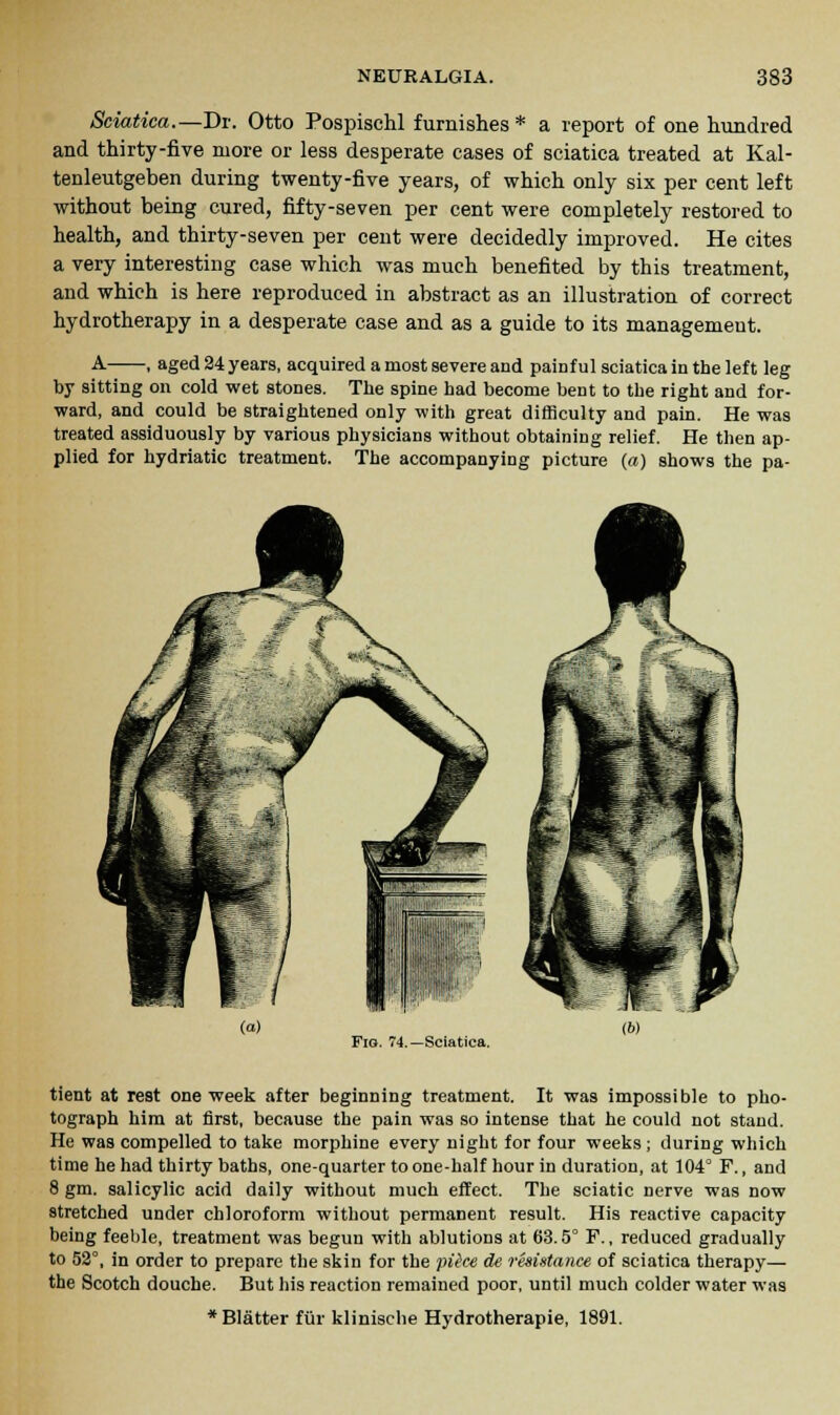 Sciatica.—Dr. Otto Pospischl furnishes* a report of one hundred and thirty-five more or less desperate cases of sciatica treated at Kal- tenleutgeben during twenty-five years, of which only six per cent left without being cured, fifty-seven per cent were completely restored to health, and thirty-seven per cent were decidedly improved. He cites a very interesting case which was much benefited by this treatment, and which is here reproduced in abstract as an illustration of correct hydrotherapy in a desperate case and as a guide to its management. A , aged 24 years, acquired a most severe and painf ul sciatica in the left leg by sitting on cold wet stones. The spine had become bent to the right and for- ward, and could be straightened only with great difficulty and pain. He was treated assiduously by various physicians without obtaining relief. He then ap- plied for hydriatic treatment. The accompanying picture (a) shows the pa- Fig. 74.—Sciatica. tient at rest one week after beginning treatment. It was impossible to pho- tograph him at first, because the pain was so intense that he could not stand. He was compelled to take morphine every night for four weeks; during which time he had thirty baths, one-quarter to one-half hour in duration, at 104° F., and 8 gm. salicylic acid daily without much effect. The sciatic nerve was now stretched under chloroform without permanent result. His reactive capacity being feeble, treatment was begun with ablutions at 63.5° F., reduced gradually to 52°, in order to prepare the skin for the pttce de resistance of sciatica therapy— the Scotch douche. But his reaction remained poor, until much colder water was