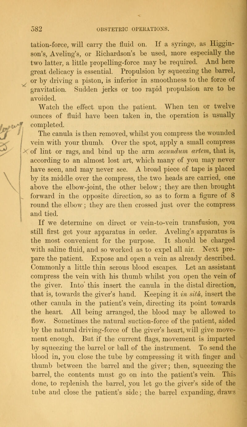 >/ tation-force, will carry the fluid on. If a syringe, as Higgin- son's, Aveling's, or Kichardson's be used, more especially the two latter, a little propelling-force may be required. And here great delicacy is essential. Propulsion by squeezing the barrel, or by driving a piston, is inferior in smoothness to the force of gravitation. Sudden jerks or too rapid propulsion are to be avoided. Watch the effect upon the patient. When ten or twelve ounces of fluid have been taken in, the operation is usually completed. The canula is then removed, whilst you compress the wounded vein with your thumb. Over the spot, apply a small compress of lint or rags, and bind up the arm secundum artem, that is, according to an almost lost art, which many of you may never have seen, and may never see. A broad piece of tape is placed by its middle over the compress, the two heads are carried, one above the elbow-joint, the other below; they are then brought forward in the opposite direction, so as to form a figure of 8 round the elbow; they are then crossed just over the compress and tied. If we determine on direct or vein-to-vein transfusion, you still first get your apparatus in order. Aveling's apparatus is the most convenient for the purpose. It should be charged with saline fluid, and so worked as to expel all air. Next pre- pare the patient. Expose and open a vein as already described. Commonly a little thin serous blood escapes. Let an assistant compress the vein with his thumb whilst you open the vein of the giver. Into' this insert the canula in the distal direction, that is, towards the giver's hand. Keeping it in situ, insert the other canula in the patient's vein, directing its point towards the heart. All being arranged, the blood may be allowed to flow. Sometimes the natural suction-force of the patient, aided by the natural driving-force of the giver's heart, will give move- ment enough. But if the current flags, movement is imparted by squeezing the barrel or ball of the instrument. To send the blood in, you close the tube by compressing it with finger and thumb between the barrel and the giver; then, squeezing the barrel, the contents must go on into the patient's vein. Thi.^ done, to replenish the barrel, you let go the giver's side of the tube and close the patient's side; the barrel expanding, draws