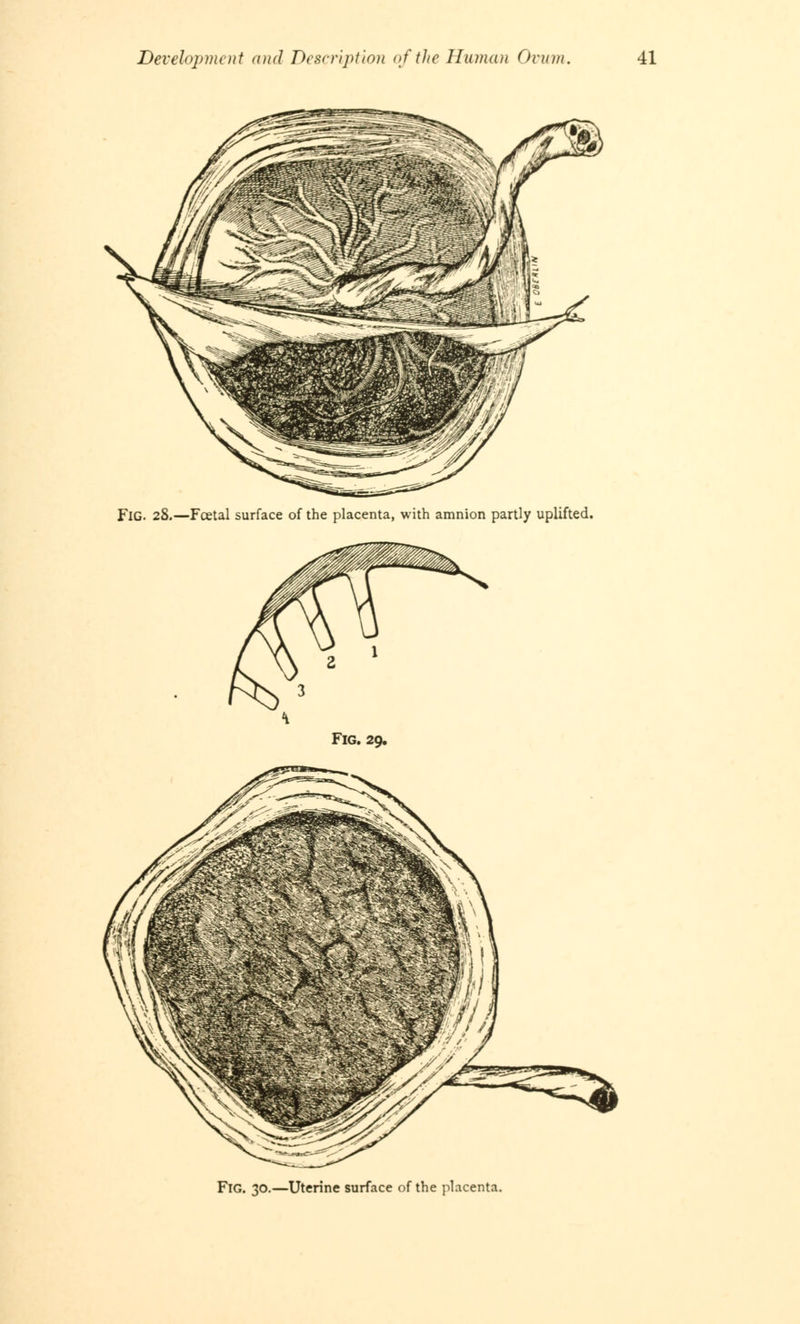 FlG. 28.—Fcetal surface of the placenta, with amnion partly uplifted. Fig. 29. Fig. 30.—Uterine surface of the placenta.