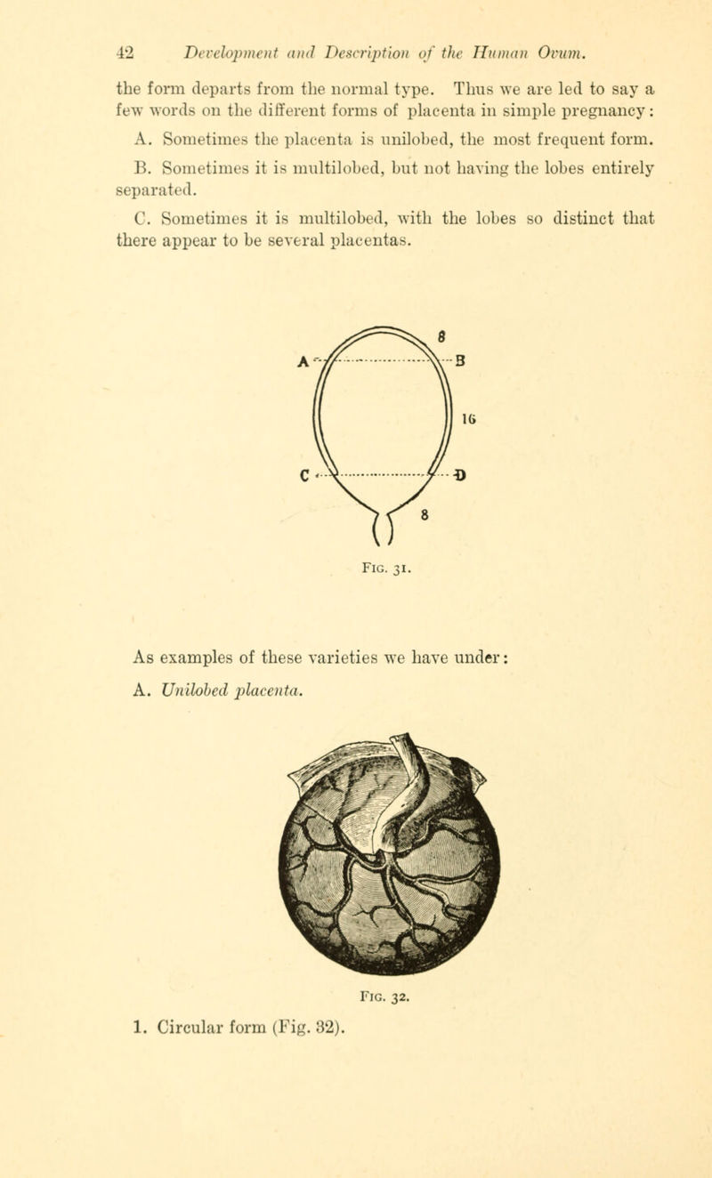 the form departs from the normal type. Thus we are led to say a few words on the different forms of placenta in simple pregnancy: A. Sometimes the placenta is unilobed, the most frequent form. B. Sometimes it is multilobed, but not having the lobes entirely separated. C. Sometimes it is multilobed, with the lobes so distinct that there appear to be several placentas. Fig. 31. As examples of these varieties we have under A. Unilobed placenta. Fig. 32.
