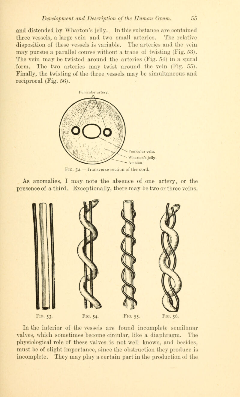 and distended by Wharton's jelly. In this Bubstance are contained three vessels, a large vein and two small arteries. The relative disposition of these vessels is variable. The arteries and the \< in may pursue a parallel course without a trace of twisting (Fig. 53). The vein may be twisted around the arteries (Fig. 54) in a spiral form. The two arteries may twist around the vein (Fig. 55). Finally, the twisting of the three vessels may be simultaneous and reciprocal (Fig. 56). Funicular artery. Funicular vein. Wharton's jelly. Amnion. Fig. 52.— Transverse section of the cord. As anomalies, I may note the absence of one artery, or the presence of a third. Exceptionally, there may be two or three veins. Fi«. 53- Fig. 54. Fig. 56. In the interior of the vessels are found incomplete semilunar valves, which sometimes become circular, like a diaphragm. The physiological role of these valves is not well known, and besides, must be of slight importance, since the obstruction they produce is incomplete. They may play a certain part in the production of the