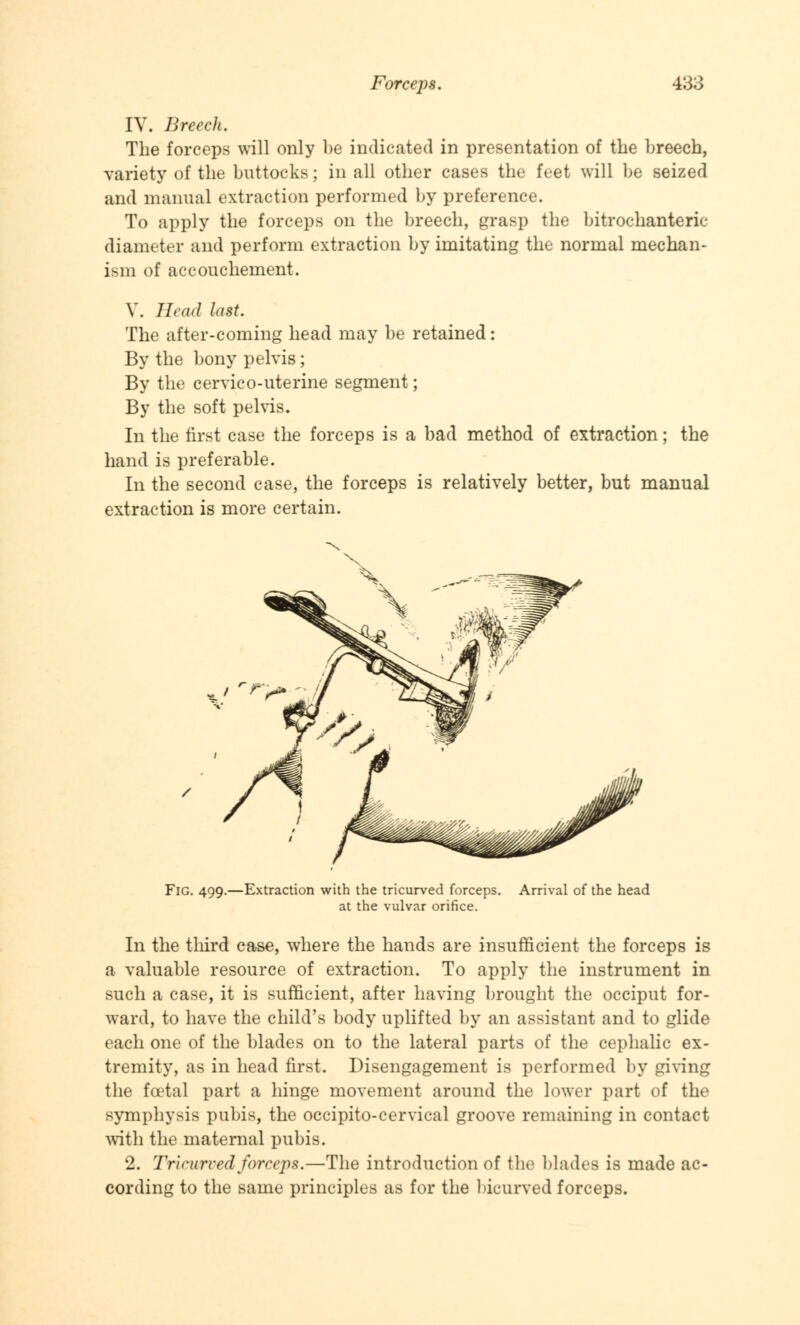 IV. Breech. The forceps will only be indicated in presentation of the breech, variety of the buttocks; in all other cases the feet will be seized and manual extraction performed by preference. To apply the forceps on the breech, grasp the bitrochanteric diameter and perform extraction by imitating the normal mechan- ism of accouchement. V. Head lust. The after-coming head may be retained: By the bony pelvis ; By the cervico-uterine segment; By the soft pelvis. In the first case the forceps is a bad method of extraction; the hand is preferable. In the second case, the forceps is relatively better, but manual extraction is more certain. Fig. 499.—Extraction with the tricurved forceps, at the vulvar orifice. Arrival of the head In the third case, where the hands are insufficient the forceps is a valuable resource of extraction. To apply the instrument in such a case, it is sufficient, after having brought the occiput for- ward, to have the child's body uplifted by an assistant and to glide each one of the blades on to the lateral parts of the cephalic ex- tremity, as in head first. Disengagement is performed by giving the foetal part a hinge movement around the lower part of the symphysis pubis, the occipitocervical groove remaining in contact with the maternal pubis. 2. Tricwrved forceps.—The introduction of the blades is made ac- cording to the same principles as for the bicnrved forceps.