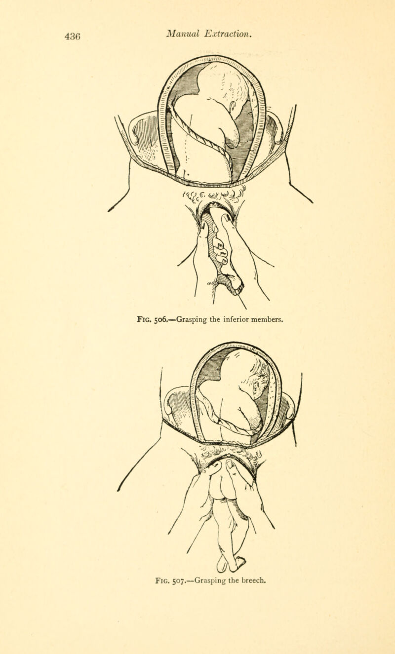 430 FlG. 506.—Grasping the inferior members. Fig. 507.—Grasping the breech.