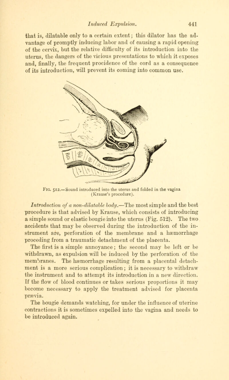 that is, dilatable only to a certain extent; this dilator has the ad- vantage of promptly inducing labor and of causing a rapid opening of the cervix, but the relative difficulty of its introduction into the uterus, the dangers of the vicious presentations to which it exposes and, finally, the frequent procidence of the cord as a consequence of its introduction, will prevent its coming into common use. Fig. 512.— Sound introduced into the uterus and folded in the vagina (Krause's procedure). Introduction of a non-dilatable body.—The most simple and the best procedure is that advised by Krause, which consists of introducing a simple sound or elastic bougie into the uterus (Fig. 512). The two accidents that may be observed during the introduction of the in- strument are, perforation of the membrane and a haemorrhage proceding from a traumatic detachment of the placenta. The first is a simple annoyance; the second may be left or be withdrawn, as expulsion will be induced by the perforation of the membranes. The haemorrhage resulting from a placental detach- ment is a more serious complication; it is necessary to withdraw the instrument and to attempt its introduction in a new direction. If the flow of blood continues or takes serious proportions it may become necessary to apply the treatment advised for placenta praevia. The bougie demands watching, for under the influence of uterine contractions it is sometimes expelled into the vagina and needs to be introduced again.
