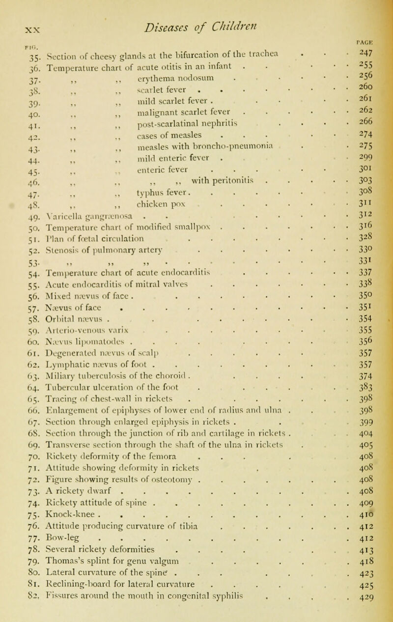 35' 3°- 37- 38- 39- 40. 41. 42. 43- 44- 45- 46. 47- 48. 49. 50. 5>- 52- 53- 54- 55- 56. 57- 58. 59. 60. 61. 62. 3- 64. 65. (id. 1.7. 6S. Oq. 70. 7'- 7?- 73- 74- 75- 76. 77- 78. 79- 80. Si. 82, Section of cheesy glands at the bifurcation of the trachea Temperature chart of acute otitis in an infant . ,, ,. erythema nodosum scarlet fever . „ mild scarlet fever . malignant scarlet fever post-scarlatinal nephritis cases of measles measles with broncho-pneumonia mild enteric fever- enteric fever ,, with peri ton typhus fever. ,. „ chicken pox Varicella gangrenosa Temperature char! of modified smallpox . Plan of foetal circulation Stenosis of pulmonary artery I) »» »» • Temperature chart of acute endocarditis Acute endocarditis of mitral valves Mixed nevus of face. Na;vus of face .... Orbital nevus . . ■ Arterio-venous varix Nicvus lipotnatodes .... Degenerated nevus of scalp Lymphatic nevus of foot . .Miliary tuberculosis of the choroid . Tubercular ulceration of the foot Tracing of chest-wall in rickets Enlargement of epiphyses of lower end of radius Section through enlarged epiphysis in rickets . Section through the junction of rib and cartilage Transverse section through the shaft of the ulna Rickety deformity of the femora Attitude showing deformity in rickets Figure showing results of osteotomy . A rickety dwarf .... Rickety attitude of spine . Knock-knee ..... Attitude producing curvature of tibia Bow-leg ..... Several rickety deformities Thomas's splint for genu valgum Lateral curvature of the spine . Keclining-board for lateral curvature Fissures around the mouth in congenital syphili d uln in rickets , n rickets