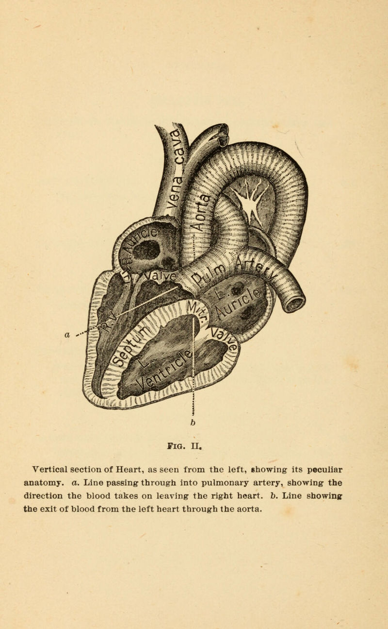 a ''Hfc Vertical section of Heart, as seen from the left, showing its peculiar anatomy, a. Line passing- through into pulmonary artery, showing the direction the blood takes on leaving the right heart, b. Line showing- the exit of blood from the left heart through the aorta.