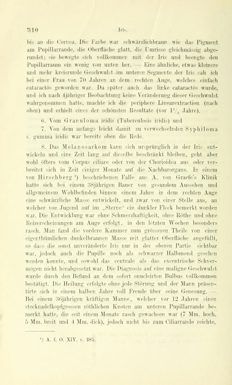 bis au die Cornea. Die Farbe war sehwärzlichbraun wie das Pigment am Pupillarrande, die Oberfläche glatt, die Umrisse gleichmässig abge- rundet; sie bewegte sieh vollkommen mit der Iris und beengte den Pupillarraum ein wenig von unten her. - Eine ähnliche, etwas kleinere und mehr kreisrunde Geschwulst .im unteren Segmente der Iris sah ich bei einer Frau von 70 Jahren an dem rechten Auge, welches einlach cataractös geworden war. Da später auch das linke cataractös wurde, und ich nach 4jähriger Beobachtung keine Veränderung dieser Geschwulst wahrgenommen hatte, machte ich die periphere Linearextraction (nach oben) und erhielt eines der schönsten Resultate (vor l1/, Jahre). 6. Vom Granuloma iridis (Tuberculosis iridis) und 7. Von dem anfangs leicht damit zu verwechselnden Syphiloma s. gumma iridis war bereits oben die Rede. 8. Das Melanosarkom kann .-ich ursprünglich in der Iris ent- wickeln und eine Zeit lang auf dieselbe beschränkt bleiben, geht aber wohl öfters vom Corpus ciliare oder von der Chorioiclea aus oder ver- breitet sich in Zeit einiger Monate auf die Nachbarorgane. In einem von Hirschberg *) beschriebenen Falle aus A. von Graefe's Klinik hatte sich bei einem 38jährigen Bauer von gesundem Aussehen und allgemeinem Wohlbefinden binnen einem Jahre in dem rechten Auge eine schwärzliche Masse entwickelt, und zwar von einer Stelle aus, an welcher von Jugend auf im „Sterne ein dunkler Fleck bemerkt worden war. Die Entwicklung war ohne Schmerzhaftigkeit. ohne Röthe und ohne Reizerscheinungen am Auge erfolgt, in den letzten Wochen besonders rasch. Man fand die vordere Kammer zum grösseren Theile von einer eigenthümlichen dunkelbraunen Masse mit glatter Oberfläche angefüllt, so dass die sonst unveränderte Iris nur in der oberen Partie sichtbar war. jedoch auch die Pupille noch als schwarzer Halbmond gesehen werden konnte, und sowohl das centrale als das exeentrische Sehver- mögen nicht herabgesetzt war. Die Diagnosis auf eine maligne Geschwulst wurde durch den Befund an dem sofort enucleirten Bulbus vollkommen bestätigt. Die Heilung erfolgte ohne jede Störung und der Mann präsen- tirte sich in einem halben Jahre voll Freude über seine Genesung. - Bei einem 30jährigen kräftigen Manne, welcher vor 12 Jahren einen stecknadelkopfgrossen röthlichen Knoten am unteren Pupillarrande be- merkt hatte, die seit einem Monate rasch gewachsen war (7 Mm. hoch, 5 Mm. breit und 4 Mm. dick), jedoch nicht bis zum Ciliarrande reichte, *) A. f. 0. XIV. c, 285.
