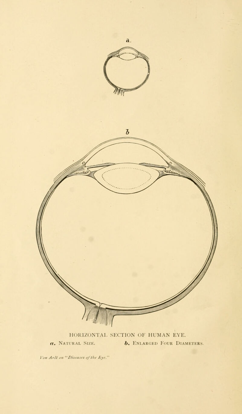 HORIZONTAL SECTION OF HUMAN EYE. a. Nati'ral Size. b. Enlarged Four Diameters. / 'on A>It on Diseases oj the Eye.