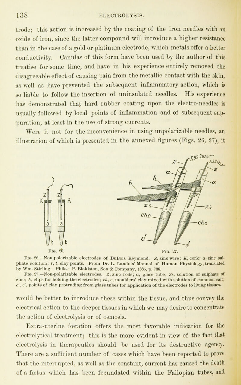 trode; this action is increased by the coating of the iron needles with an oxide of iron, since the latter compound will introduce a higher resistance than in the case of a gold or platinum electrode, which metals offer a better conductivity. Canulas of this form have been used by the author of this treatise for some time, and have in his experience entirely removed the disagreeable effect of causing pain from the metallic contact with the skin, as well as have prevented the subsequent inflammatory action, which is so liable to follow the insertion of uninsulated needles. His experience has demonstrated that hard rubber coating upon the electro-needles is iisually followed by local points of inflammation and of subsequent sup- puration, at least in the use of strong currents. Were it not for the inconvenience in using unpolarizable needles, an illustration of which is presented in the annexed figures (Figs. 2G, 27), it ; z t \Jt Fig. *. Fig. Fig. '30.—Non-polarizable electrodes of DuBois Reymond. Z, zinc wire; A, cork; a, zinc sul- phate solution; f, r, clay points. From Dr. L. Landois1 Manual of Human Physiology, translated by Wm. Stirling. Phila.: P. Blakiston, Son & Company, 18a?, p. 736. Fig. 27.—Non-polarizable electrodes. Z, zinc rods; a, glass tube; Zs, solution of sulphate of zinc; h, clips for holding the electrodes; ch, c, moulders1 clay mixed with solution of common salt; c\ c\ points of clay protruding from glass tubes for application of the electrodes to living tissues. would be better to introduce these within the tissue, and thus convey the electrical action to the deejier tissues in which we may desire to concentrate the action of electrolysis or of osmosis. Extra-uterine fcetation offers the most favorable indication for the electrolytical treatment; this is the more evident in view of the fact that electrolysis in therapeutics should be used for its destructive agency. There are a sufficient number of cases which have been reported to prove that the interrupted, as well as the constant, current has caused the death of a foetus which has been fecundated within the Fallopian tubes, and