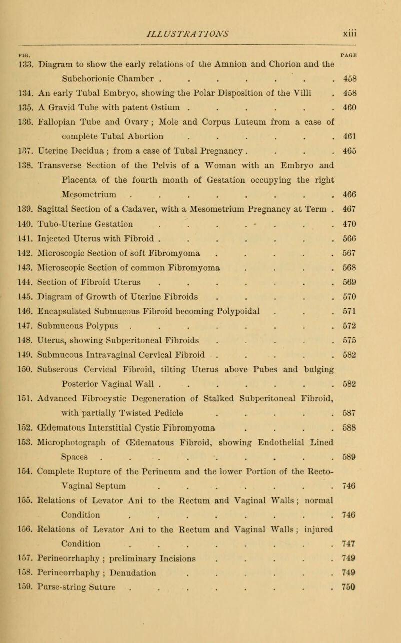 KIG. 133. Diagram to show the early relations of the Amnion and Chorion and the Subchorionic Chamber ....... 134. An early Tubal Embryo, showing the Polar Disposition of the Villi 135. A Gravid Tube with patent Ostium ...... 136. Fallopian Tube and Ovary ; Mole and Corpus Luteum from a case of complete Tubal Abortion ...... 137. Uterine Decidua ; from a case of Tubal Pregnancy .... 138. Transverse Section of the Pelvis of a Woman with an Embryo and Placenta of the fourth month of Gestation occupying the right Mesometrium ........ 139. Sagittal Section of a Cadaver, with a Mesometrium Pregnancy at Term . 140. Tubo-Uterine Gestation . . . . - . 141. Injected Uterus with Fibroid ..... 142. Microscopic Section of soft Fibromyoma 143. Microscopic Section of common Fibromyoma 144. Section of Fibroid Uterus ..... 145. Diagram of Growth of Uterine Fibroids 146. Encapsulated Submucous Fibroid becoming Polypoidal 147. Submucous Polypus ...... 148. Uterus, showing Subperitoneal Fibroids 149. Submucous Intra vaginal Cervical Fibroid 150. Subserous Cervical Fibroid, tilting Uterus above Pubes and bulging Posterior Vaginal Wall ..... 151. Advanced Fibrocystic Degeneration of Stalked Subperitoneal Fibroid, with partially Twisted Pedicle 152. Edematous Interstitial Cystic Fibromyoma 153. Microphotograph of Q2dematous Fibroid, showing Endothelial Lined Spaces ....... 154. Complete Rupture of the Perineum and the lower Portion of the Recto- Vaginal Septum ..... 155. Relations of Levator Ani to the Rectum and Vaginal Walls ; normal Condition ...... 156. Relations of Levator Ani to the Rectum and Vaginal Walls ; injured Condition ...... 1>7. Perineorrhaphy; preliminary Incisions 158. Perineorrhaphy ; Denudation .... 159. Purse-string Suture ...... PAGE 458 458 460 461 465 466 467 470 566 567 568 569 570 571 572 575 582 582 587 588 589 746 746 747 749 749 750