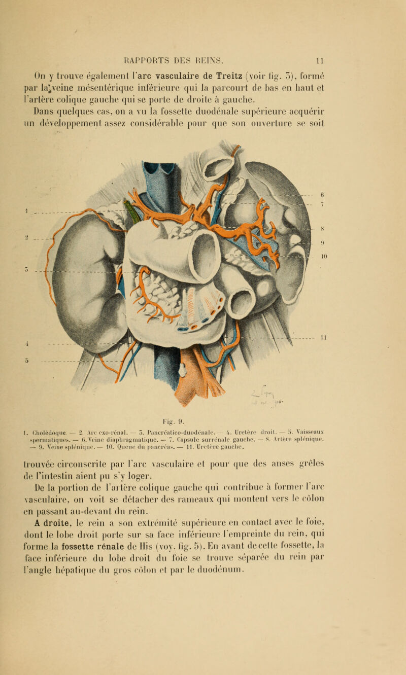 On y trouve également Parc vasculaire de Treitz (voir lig. 3), formé par la^veine mésentérique inférieure qui la parcourt de bas en haut et l'artère colique gauche qui se porte de droite à gauche. Dans quelques cas, on a vu la fossette duodénale supérieure acquérir un développement assez considérable pour que son ouverture se soit Fig. i). I. Cholédoque — w2. Arc exo-rénal.— 5. Pancréatico-duodénâle. — 4. Uretère droit.— 5. Vaisseaux spermatiques. — 6. Veine diaphragmatique. — 7. Capsule surrénale gauche. — S. Artère splénique. — 9. Veine splénique.— 10. Queue du pancréas.— 11. Uretère gauche. trouvée circonscrite par l'arc vasculaire et pour que des anses grêles de l'intestin aient pu s'y loger. De la portion de l'artère colique gauche qui contribue à former I arc vasculaire, on voit se détacher des rameaux qui montent vers le colon en passant au-devant du rein. A droite, le rein a son extrémité supérieure en contact avec le foie, dont le lobe droit porte sur sa face inférieure l'empreinte du rein, qui forme la fossette rénale de Dis (voy. fig. 5). En avant de celte fossette, la face inférieure du lobe droit du foie se trouve séparée du rein par l'angle hépatique du gros côlon et par le duodénum.