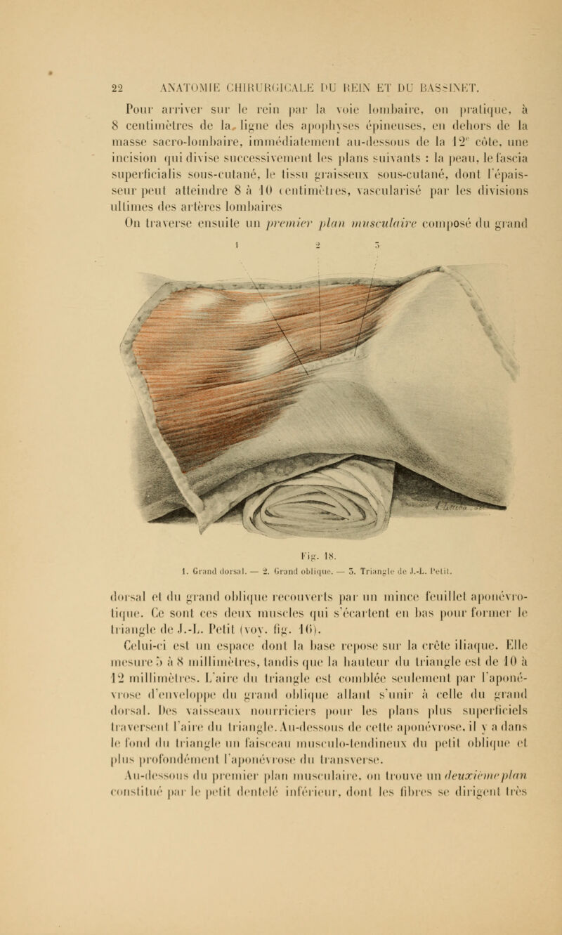 Pour arriver sur le rein par la voie lombaire, on pratique, à 8 centimètres de la ligue des apophyses épineuses, en dehors de la masse sacro-lombaire, immédiatement au-dessous de la 1*2' cote, une incision qui divise successivement les plans suivants : la peau, lefascia superficialis sous-cutané, le tissu graisseux sous-cutané, dont l'épais- seur peut atteindre 8 à 10 centimètres, vascularisé par les divisions ultimes des artères lombaires On traverse ensuite un pronier plan musculaire composé du grand ai^ Fig. IN. 1. Grand dorsal. — i. Grand oblique. — 5. Triangle de J.-L. Petit. dorsal et du grand oblique recouverts par un mince feuillet aponévro- tique. Ce sont ces deux muscles qui s'écartent eu bas pour former le triangle de J.-L. Petit (voy. fig. 10). Celui-ci est un espace dont la base repose sur la crête iliaque. Elle mesure') à (S millimètres, tandis que la hauteur du triangle esl de 10 à \2 millimètres. L'aire du triangle est comblée seulement par l'aponé- vrose d'enveloppe du grand oblique allant s'unir à celle du grand dorsal. I)es vaisseaux nourriciers pour les plans plus superficiels traversent l'aire du triangle. Au-dessous de celle aponévrose, il y a dans le fond du triangle un faisceau musculo-tendineux du petit oblique et plus profondément l'aponévrose du transverse. Au-dessous du premier plan musculaire, on trouve un deuxième plan constitué par le petit dentelé inférieur, dont les fibres se diligent très