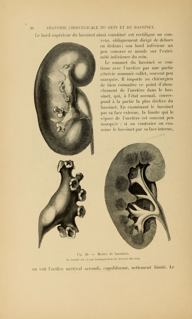 Le bord supérieur du bassinet ainsi constitué est rectiligne ou con- vexe, obliquement dirigé de dehors en dedans ; son bord inférieur un peu concave se moule sur l'extré- mité inférieure du rein. Le sommet du bassinet se con- tinue avec l'uretère par une partie rétrécie nommée collet, souvent peu marquée. 11 importe au chirurgien de bien connaître ce point d'abou- chement de l'uretère dans le bas- sinet, qui, à Fétat normal, corres- pond à la partie la plus déclive du bassinet. En examinant le bassinet par sa face externe, la limite qui le sépare de l'uretère est souvent peu marquée : si au contraire on exa- mine le bassinet par sa face interne, Fig. 26 — Moules de bassinets. Le moule est vu par transparence au travers «lu rein. ni voit l'orifice mêlerai arrondi, cupuliforme, nettement limité. Le
