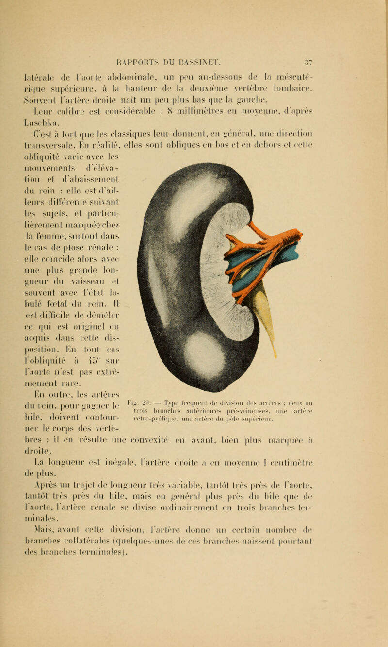 latérale de l'aorte abdominale, un peu au-dessous de la mésentê- rique supérieure, à la hauteur de la deuxième vertèbre lombaire. Souvenl l'artère droite naît un peu plus bas que la gauche. Leur calibre est considérable : 8 millimètres eu moyenne, d'après Luschka. C'est à tort que les classiques leur donnent, eu général, une direction transversale. En réalité, elles sont obliques ou bas cl en dehors <ài cette obliquité varie avec les mouvements d'éléva- tion et d'abaissement du rein : elle est d'ail- leurs différente suivant les sujels, cl particu- lièrement marquée chez la femme, surtout dans le cas de plose rénale : (die coïncide alors avec une plus grande lon- gueur du vaisseau el souvenl avec l'état lo- bule fœtal du rein. M est difficile de démêler ce qui est originel ou acquis dans celle dis- position. En tout cas l'obliquité ;i i-V sur l'aorte n'est pas ex I re- niement rare. En outre, les artères du rein, pour gagner le Fi*- ~x ~ T™e IVr,il,onl tle ,iiviH,m !los artères : deux.on .' trois branches antérieures pre-vemeuses, une artère bile, doivent Contour- rétro-pyélique, une artère du pôle supérieur, ner le corps des vertè- bres : il en résulte une convexité en avant, bien plus marquée à droite. La longueur est inégale, l'artère droite a en moyenne 1 centimètre de plus. Après un trajel de longueur 1res variable, tantôt très près de l'aorte, tantôt 1res près du bile, mais en général plus près du bile que de l'aorte, Tarière rénale se divise ordin.'iiretnenl en trois branches ter- minales. Mais, avanl celle division, l'artère donne un certain nombre de branches collatérales (quelques-unes de ces branches naissent pourtanl des branches terminales).