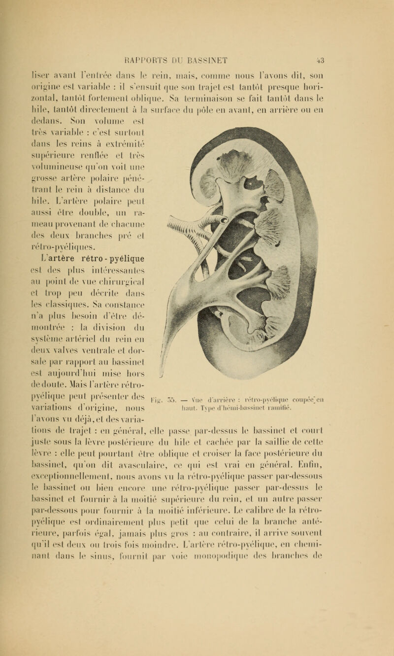 liser avant l'entrée dans le rein, mais, comme nous l'avons dit, son origine est variable : il s'ensuit que son trajet est tantôt presque hori- zontal, tantôt fortement oblique. Sa terminaison se fait tantôt dans le hile, tantôt directement à la surface du pôle en avant, en arrière ou en dedans. Son volume est très variable : c'est surtout dans les reins à extrémité supérieure renflée et très volumineuse qu'on voit une grosse artère polaire péné- trant le rein à distance du bile. L'artère polaire peut aussi être double, un ra- meau provenant de chacune des deux branches pré et rétro-pyéliques. L artère rétro-pyélique est des plus intéressantes au point de vue chirurgical et trop peu décrite dans les classiques. Sa constance n'a plus besoin d'être dé- montrée : la division du système artériel du rein en deux valves ventrale et dor- sale par rapport au bassinet est aujourd'hui mise hors de doute. Mais l'artère rétro- pyélique peut présenter des variations d'origine, nous l'avons vu déjà, et des varia- tions de trajet : en général, elle passe par-dessus le bassinet et court juste sous la lèvre postérieure du bile et cachée par la saillie de celte lèvre : elle peut pourtant être oblique et croiser la l'ace postérieure du bassinet, qu'on dit avasculaire, ce qui est vrai en général. Enfin, exceptionnellement, nous avons vu la rétro-pyélique passer par-dessous le bassinet ou bien encore une rélro-pyélique passer par-dessus le bassinet et fournil' à la moitié supérieure du rein, et un autre passer par-dessous pour fournir à la moitié inférieure. Le calibre de la rélro- pyélique est ordinairement plus petit que celui de la branche anté- rieure, parfois égal, jamais plus gros : au contraire, il arrive souvenl qu'il est deux ou trois fois moindre. L'artère rétro-pyéliquo, en chemi- nant dans le sinus, fournil par voie monopodique des branches de Fig. 55. — Vue d'arrière liant. Type d'hémi •étro-pyélique coupée]en ssinel ramifié.