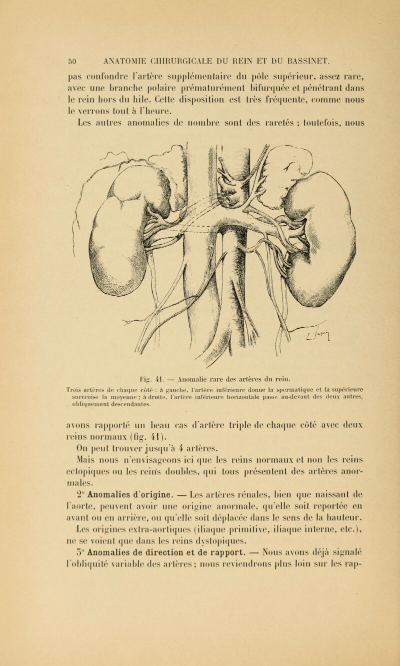 pas confondre l'artère supplémentaire du pôle supérieur, assez rare, avec une branche polaire prématurément bifurquée et pénétrant dans le rein hors du hile. Cette disposition est très fréquente, comme nous le verrons tout à l'heure. Les autres anomalies de nombre sont des raretés ; toutefois, nous Fig. 41. — Anomalie rare des artères du rein. Trois artères de chaque côté : à gauche, l'artère inférieure donne la spermatique et la supérieure surcroise la moyenne; adroite, l'artère inférieure horizontale passe au-devant des deux autres, obliquement descendantes. avons rapporté un beau cas d'artère triple de chaque coté avec deux reins normaux (fig. H ). On peu! trouver jusqu'à 4 artères. Mais nous u'envisageons ici (pie les reins normaux et non les reins ectopiques ou les reins doubles, qui tous présentent des artères anor- males. 2° Anomalies d'origine. — Les artères rénales, bien (pie naissant de I aorte, peuvent avoir une origine anormale, qu'elle soit reportée en avant ou en arrière, ou qu'elle soil déplacée dans le sens de la hauteur. Les origines extra-aortiques (iliaque primitive, iliaque interne, etc.), ne se voient que dans les reins dystopiques. 3° Anomalies de direction et de rapport. — Nous avons déjà signalé l'obliquité variable des artères; nous reviendrons plus loin sur les iap-