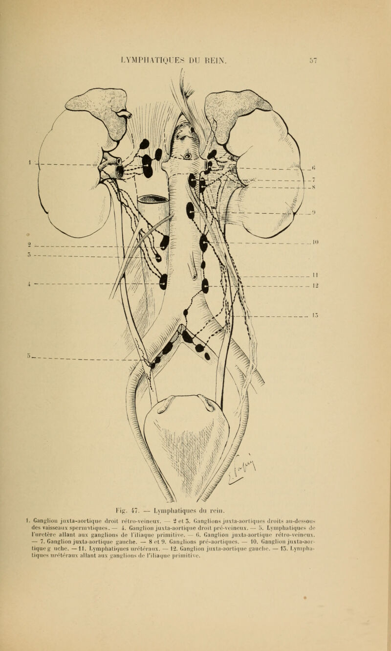 Fig. 47. — Lymphatiques du rein. I. Ganglion juxta-aortique droit rétro-veineux. — 2et3. Ganglions juxta-aortiques droits au-dessous des vaisseaux spermitiques. — -i. Ganglion juxta-aortique droit pré-veineux. — 5. Lymphatiques de L'uretère allant aux ganglions de l'iliaque primitive. •>. Ganglion juxta-aortique rétro-veineux. — 7. Ganglion juxta-aortique gauche. — 8 et 9. Ganglions pré-aortiques. — 10. Ganglion juxta-aor- tique g uche. —11. Lymphatiques urétéraux. — 12. Ganglion juxta-aortique gauche. — 13. Lympha tiques urétéraux allant aux ganglions <\<' l'iliaque primitive.