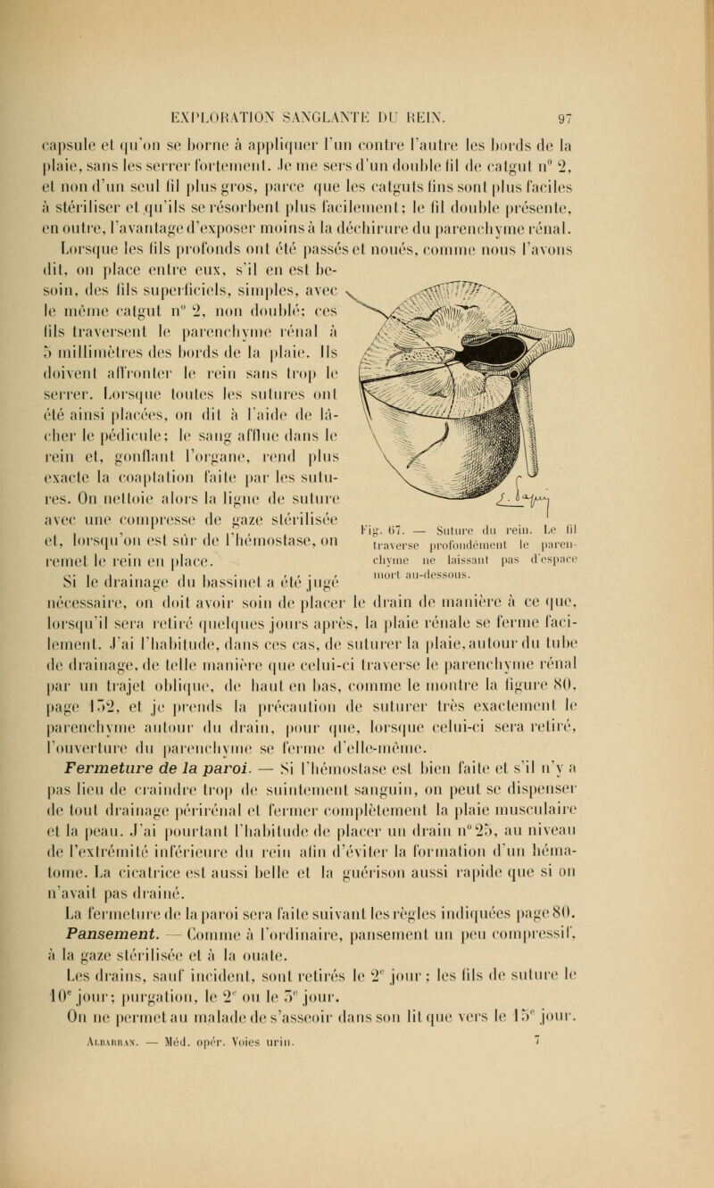 Fig. 07. — Suture du rein. Le traverse profondément le paren- chyme ne laissant pas d'espace mort au-dessous. capsule et qu'on se borne à appliquer l'un contre l'autre les bords de la plaie, sans les serrer fortement. Je nie sers d'un double fil de catgut n° 2, et non d'un seul fil plus gros, parce que les catguts lins sont plus faciles à stériliser et qu'ils se résorbent plus facilement; le fil double présente, en outre, l'avantage d'exposer moins à la déchirure du parenchyme rénal. Lorsque les fils profonds ont été passés et noués, comme nous l'avons dit, on place entre eux, s'il en est be- soin, des fils superficiels, simples, avec le môme catgut n° 2, non doublé; ces fils traversent le parenchyme rénal à 5 millimètres des bords de la plaie. Ils doivent affronter le rein sans trop le serrer. Lorsque toutes les sutures ont été ainsi placées, on dit à l'aide de là- cher le pédicule; le sang afflue dans le rein et, gonflant l'organe, rend plus exacte la coaptation faite par les sutu- res. On nettoie alors la ligne de suture avec une compresse de gaze stérilisée et, lorsqu'on est sûr de l'hémostase, on remet le rein en place. Si le drainage du bassinet a été jugé nécessaire, on doit avoir soin de placer le drain de manière à ce que, lorsqu'il sera retiré quelques jours après, la plaie rénale se ferme faci- lement. J'ai l'habitude, dans ces cas, de suturer la plaie, autour du tube de drainage, de telle manière que celui-ci traverse le parenchyme rénal par un trajet oblique, de haut en bas, comme le montre la figure 80, page 1Ô2, et je prends la précaution de suturer très exactement le parenchyme autour du drain, pour que, lorsque celui-ci sera retiré, l'ouverture du parenchyme se ferme d'elle-même. Fermeture de la paroi. — Si l'hémostase est bien faite et s'il n'y a pas lieu de craindre trop de suintement sanguin, on peut se dispenser de tout drainage périrénal et fermer complètement la plaie musculaire et la peau. J'ai pourtant l'habitude de placer un drain n°25, au niveau de l'extrémité inférieure du rein afin d'éviter la formation d'un héma- tome. La cicatrice est aussi belle et la guérison aussi rapide que si on n'avait pas drainé. La fermeture de la paroi sera faite suivant les règles indiquées page 80. Pansement. — Comme à l'ordinaire, pansement un peu compressif, à la gaze stérilisée et à la ouate. Les drains, sauf incident, sont retirés le 2e jour ; les fils de suture le 10e jour; purgation, le 2 ou le 3e jour. On ne permet au malade de s'asseoir dans son lit que vers le 15e joui'. Albarran. — Méd. opér. Voies urin. '