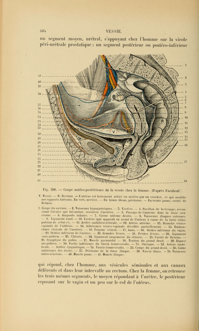 un segment moyen, urétral, s'appuyant chez l'homme sur là virole péri-urétrale prostatique ; un segment postérieur ou postéro-inférieui \—  fâfc s M Et. 9 r- 10 L— 11 12 llïP 1~ 'JJ- --- n -_ 15 - 16 18 Fig. 200. — Coupe antéro-postérieure de la vessie chez la femme. (D'après Farabeuf.) V. Vessie. — R. Rectum. — L'utérus est fortement attiré eu arrière par un crochet, ce qui modifie ses rapports latéraux. En vert, uretère. —En teinte bleue, péritoine. — En teinte jaune, cavité de Retzius. I. Coupe du samini. — 2. Vaisseaux hypogastriques. — 3. Uretère. — i. Pavillon de la trompe, recou- vrant l'ovaire qui lui-même recouvre l'uretère. — 5. Passage de l'utérine dans la fosse ova- rienne. — t>. Ampoule tubaire. — 7. Corne utérine droite. — 8. Vaisseaux iliaques externes. - 9. Ligament rond. — 10. Uretère (qui apparaît en avant de l'utérus à cause de la forte rétro- pulsion de celui-ci). — 11. Altère omhilico-vésicale. —12. Artère utérine. —13. Branche vésico- vaginale «le l'utérine. — 14. Adhérence vésico-vaginale décollée partiellement. — 15. Embou- chure vésicale de l'uretère. —16. Trigone vésical. — 17. Anus. — 18. Orilice inférieur du vagin. - 19. Orifice inférieur de l'urètre. — 20. Grandes lèvres. — 21. Petites lèvres. —22. Ligamenl sous-pubien.— 23. Clitoris. —24. Ligament suspenseur du clitoris. — ±'>. Cavité do Retzius. — 26. Symphyse du pubis. - 27. Muscle pyramidal — 28. Tendon du grand droit. — 29. Espace sus-pubien. — 30. Partie inférieure du fascia transversalis. — 51. Ouraque. —32. Artère ombi- licale. Artère épigastrique. — 34. Fascia transversalis. —35. Coupe du grand droit. — 36. Gaîne antérieure des droits. — 37. Péritoine de la fosse iliaque. --58. Fascia iliaca. - 39. Vaisseaux uléro-ovariens. 40. Muscle psoas. — il. Muscle iliaque. qui répond, chez l'homme, aux vésicules séminales cl aux canaux déférents H dans leur intervalle au rectum, (liiez la femme, on retrouve les trois mêmes segments, le moyen répondant à l'urètre, le postérieur reposant suc le vagin et \\\\ peu sur le col de l'utérus.