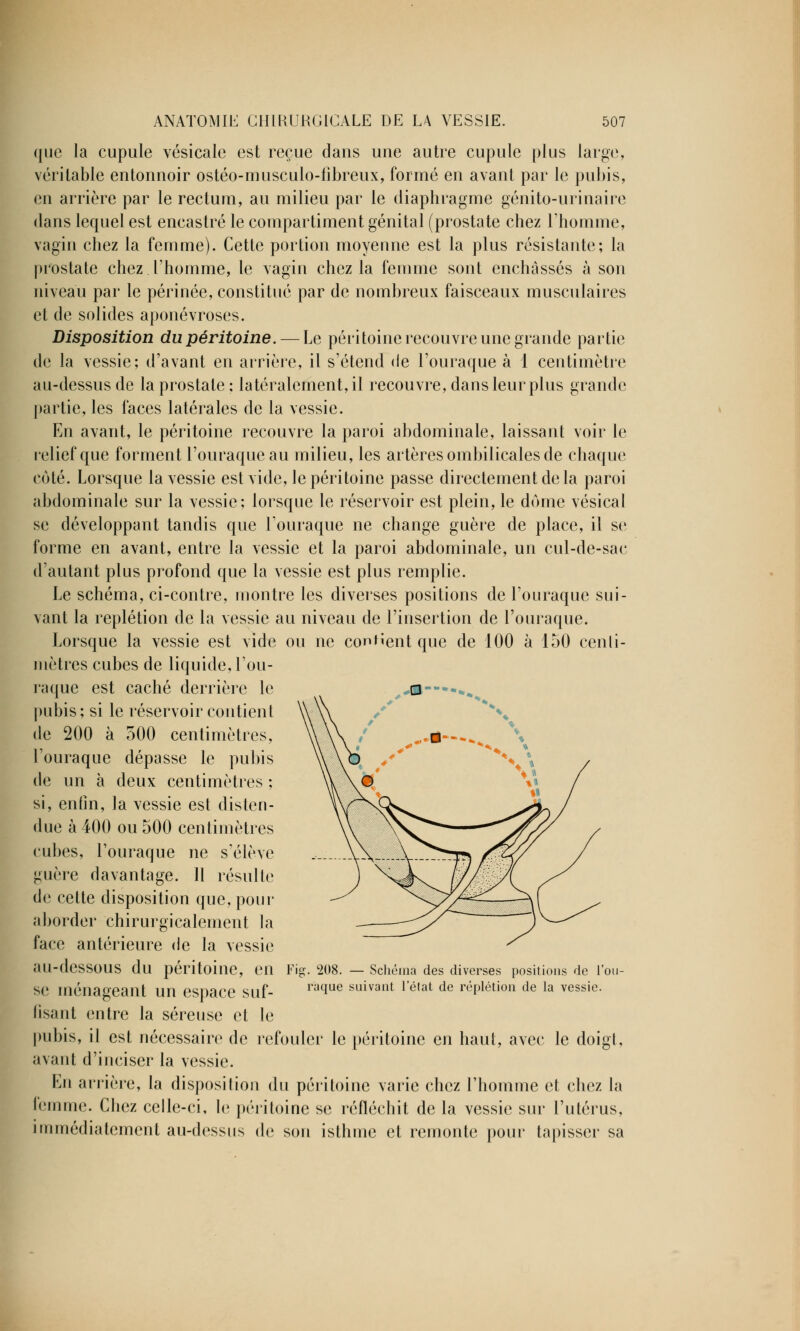 que la cupule vésicalc est reçue dans une autre cupule plus large, véritable entonnoir ostéo-musculo-fibreux, formé en avant par le pubis, en arrière par le rectum, au milieu par le diaphragme génito-urinaire dans lequel est encastré le compartiment génital (prostate chez l'homme, vagin chez la femme). Cette portion moyenne est la plus résistante; la prostate chez l'homme, le vagin chez la femme sont enchâssés à son niveau par le périnée, constitué par de nombreux faisceaux musculaires et de solides aponévroses. Disposition du péritoine. — Le péritoine recouvre une grande partie de la vessie; d'avant en arrière, il s'étend de l'ouraque à 1 centimètre au-dessus de la prostate: latéralement, il recouvre, dans leur plus grande partie, les faces latérales de la vessie. En avant, le péritoine recouvre la paroi abdominale, laissant voir le relief que forment l'ouraque au milieu, les artères ombilicales de chaque coté. Lorsque la vessie est vide, le péritoine passe directement de la paroi abdominale sur la vessie; lorsque le réservoir est plein, le dôme vésical se développant tandis que l'ouraque ne change guère de place, il se forme en avant, entre la vessie et la paroi abdominale, un cul-de-sac d'autant plus profond que la vessie est plus remplie. Le schéma, ci-contre, montre les diverses positions de l'ouraque sui- vant la replétion de la vessie au niveau de l'insertion de l'ouraque. Lorsque la vessie est vide ou ne contient que de 100 à 150 centi- mètres cubes de liquide, l'ou- raque est caché derrière le pubis; si le réservoir contient de 200 à 500 centimètres, l'ouraque dépasse le pubis de un à deux centimètres ; si, enfin, la vessie est disten- due à 400 ou 500 centimètres cubes, l'ouraque ne s'élève guère davantage. 11 résulte de cette disposition que, pour aborder chirurgicalement la face antérieure de la vessie au-dessous du péritoine, en se ménageant un espace suf- fisant entre la séreuse et le pubis, il est nécessaire de refouler le péritoine en haut, avec le doigt, avant d'inciser la vessie. En arrière, la disposition du péritoine varie chez l'homme et cbez la femme. Cbez celle-ci, le péritoine se réfléchit de la vessie sur l'utérus, immédiatement au-dessus de son isthme et remonte pour tapisser sa a Fig. 208. — Schéma des diverses positions de l'ou- raque suivant l'état de replétion de la vessie.