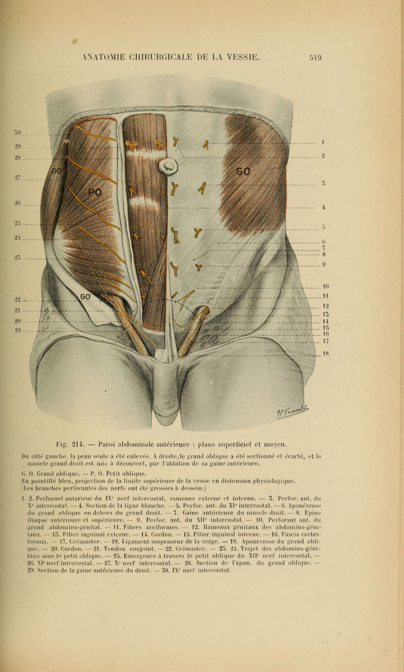 26 2l__ Di côté g nuscle Fig. 214. — Paroi abdominale antérieure : plans superficiel et moyen, auche, la peau seule a été enlevée. A droite,le grand oblique a été sectionné et écarté, et le and droit est mis à découvert, par l'ablation de sa gaine antérieure. G. 0. Grand oblique. — P. 0. Petit oblique. En pointillé bleu, projection de la limite supérieure de la vessie en distension physiologique. (Les branches perforantes des nerfs ont été grossies à dessein.) I. ±. Perforant antérieur du IXe nerf intercostal, rameaux externe et interne. — 3. Perfor. ant. du Xe intercostal. — k. Section de la ligne blanche. — 5. Perfor. ant. du XP intercostal. —6. Aponévrose du grand oblique en dehors du grand droit. — 7. Gaine antérieure du muscle droit. — 8. Epine iliaque antérieure et supérieure.— 9. Peifor. ant. du XIIe intercostal.— 10. Perforant ant. du grand abdomino-génital. — 11. Fibres arciformes. — 12. Rameaux génitaux des abdomino-géni- taux. 15. Pilier inguinal externe. — 14. Gordon. — 15. Pilier inguinal interne. — 16. Fascia crebri- formis. — 17. Crémaster. — 18. Ligament suspenseur de la verge. — 19. Aponévrose du grand obli- que. — 20. Gordon. — 21. Tendon conjoint. — 22. Crémaster. — 23. 21. Trajet des abdomino-géni- taux -ous le petit oblique. — 25. Emergence à travers le petit oblique du XIP nerf intercostal. — 26. XIe nerf intercostal. — 27. Xe nerf intercostal.— 28. Section de l'apon. du grand oblique.— 29. Section de la gaine antérieure du droit. — 50. IX nerf intercostal.