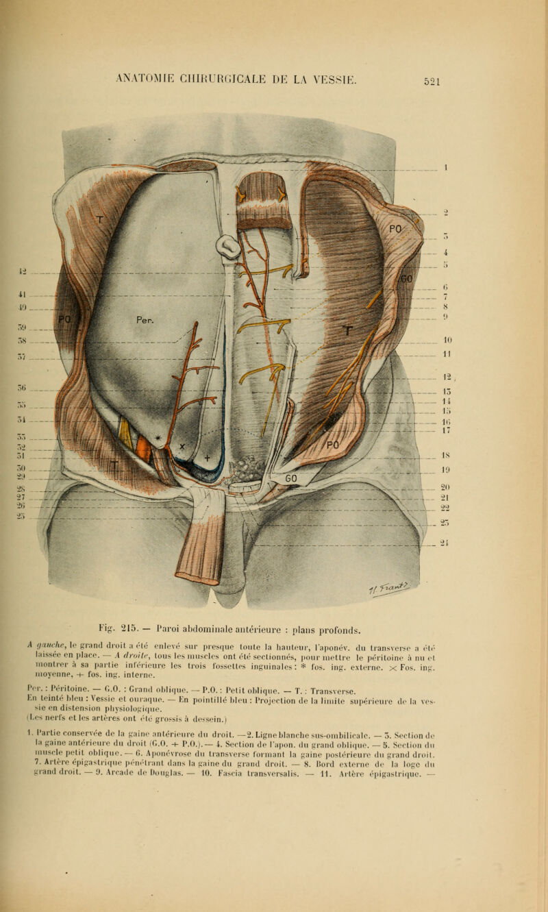 fl.&gP Fig'. 215. — Paroi abdominale antérieure : plans profonds. A gauche, le grand droit a été enlevé sur presque toute la hauteur, l'aponév. du transverse a été laissée en place. — .4 droite, tous les muselés ont été sectionnés, pour mettre le péritoine à nu et montrer à sa partie inférieure les trois fossettes inguinales: * fos. ing. externe, x Fos. ing. moyenne, -+- fos. ing. interne. Per. : Péritoine. — C.O. : Grand oblique. — P.O. : Petit oblique. — T. : Transverse. F.n teinté bleu : Vessie et ouraque. — En pointillé bleu : Projection de la limite supérieure de la ves- sie en distension physiologique. Les nerfs et les artères ont été grossis à dessein.) 1. Partie conservée de la gaine antérieure du droit. — 2. Ligne blanche sus-ombilicale. — 3. Section de la gaine antérieure du droit (G.O. ■+ P.O.).— i. Section de l'apon. du grand oblique. — 5. Section du muscle petit oblique. — 6. Aponévrose du transverse tonnant la gaine postérieure du grand droit. 7. Artère épigastrique pénétrant dans la gaine du grand droit. — 8. lîord externe de la loge du grand droit. — 9. Arcade de Douglas. — 10. Fascia transversalis. — 11. Artère épigastrique. —