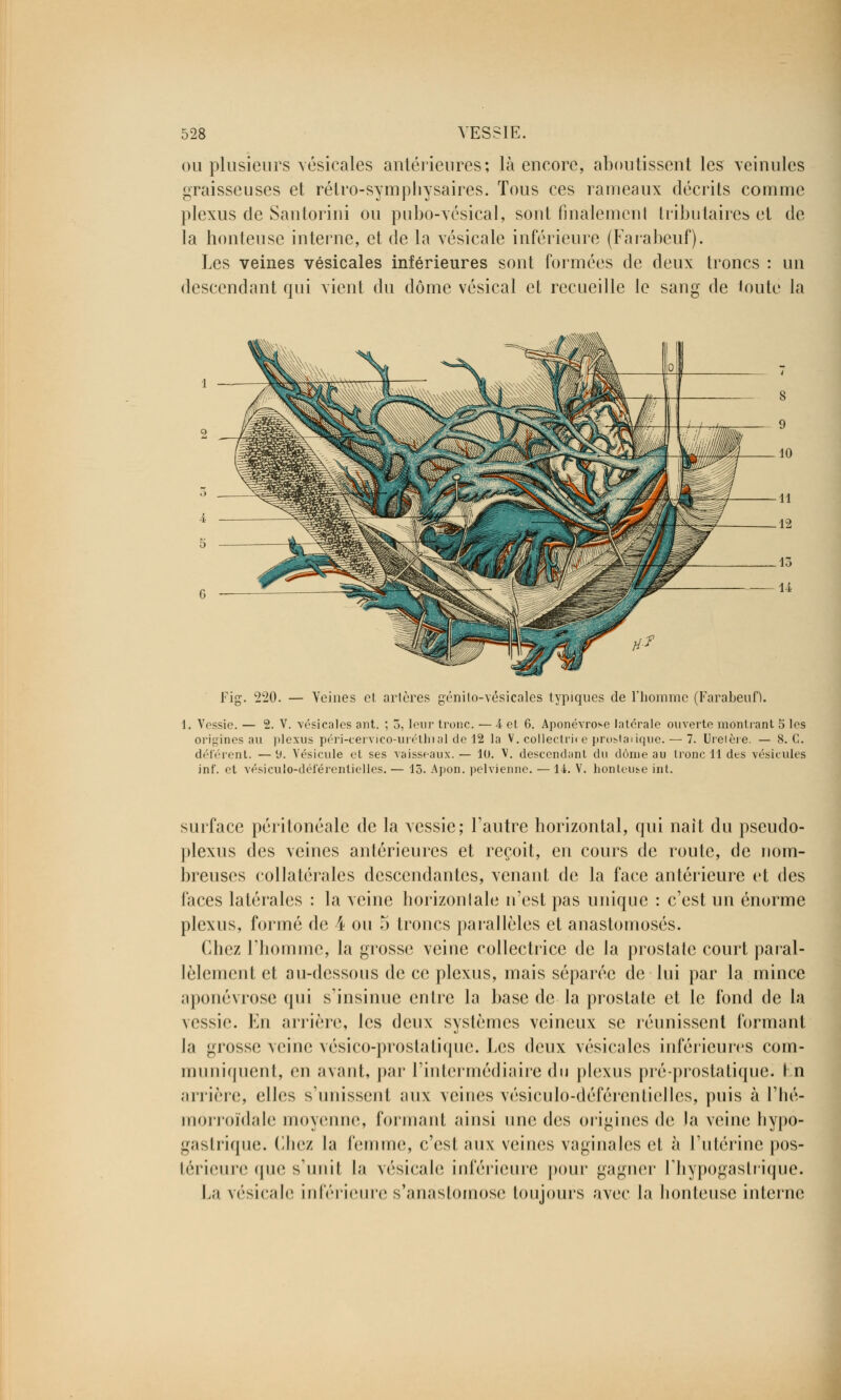 ou plusieurs vésicales antérieures; là encore, aboutissent les veinules graisseuses et rélro-symphysaires. Tous ces rameaux décrits comme plexus de Santorini ou pubo-vésical, sont finalement tributaires et de la honteuse interne, et de la vésicale inférieure (Farabeuf). Les veines vésicales inférieures sont formées de deux troncs : un descendant qui vient du dôme vésical et recueille le sang de mute la Fig. 220. — Veines et artères génilo-vésicales typiques de l'homme (Farabeuf). 1. Vessie. — 2. V. vésicales ant. ; 5, leur tronc. — A et 6. Aponévrose latérale ouverte montrant 5 les origines au plexus péri-cervico-uréthial de 12 la V. collectrice prostatique. — 7. Uretère. — 8. C. déférent. —9. Vésicule et ses vaisseaux.— 10. V. descendant du dôme au tronc 11 des vésicules inf. et vésiculo-déférentielles. — 13. Apon. pelvienne. — 14. V. honleui-e int. surface péritonéale de la vessie; l'autre horizontal, qui naît du pseudo- plexus des veines antérieures et reçoit, en cours de route, de nom- breuses collatérales descendantes, venant de la face antérieure et des faces latérales : la veine borizonlale n'est pas unique : c'est un énorme plexus, formé de 4 ou 5 troncs parallèles et anastomosés. Chez l'homme, la grosse veine collectrice de la prostate court paral- lèlement et au-dessous de ce plexus, mais séparée de lui par la mince aponévrose qui s'insinue entre la base de la prostate et le fond de la vessie. En arrière, les deux systèmes veineux se réunissent formant la grosse veine vésico-proslalique. Les deux vésicales inférieures com- muniquent, eu avant, par L'intermédiaire du plexus pré-prostatique. I n arrière, elles s'unissent aux veines vésiculo-déférentielles, puis à l'hé- morroïdale moyenne, formant ainsi nue des origines de la veine liypo- gastrique. Chez la femme, c'est aux veines vaginales et à l'utérine pos- térieure que s'unit la vésicale inférieure poui gagne hypogastrique. La vésicale inférieure s'anaslomose toujours avec la honteuse interne