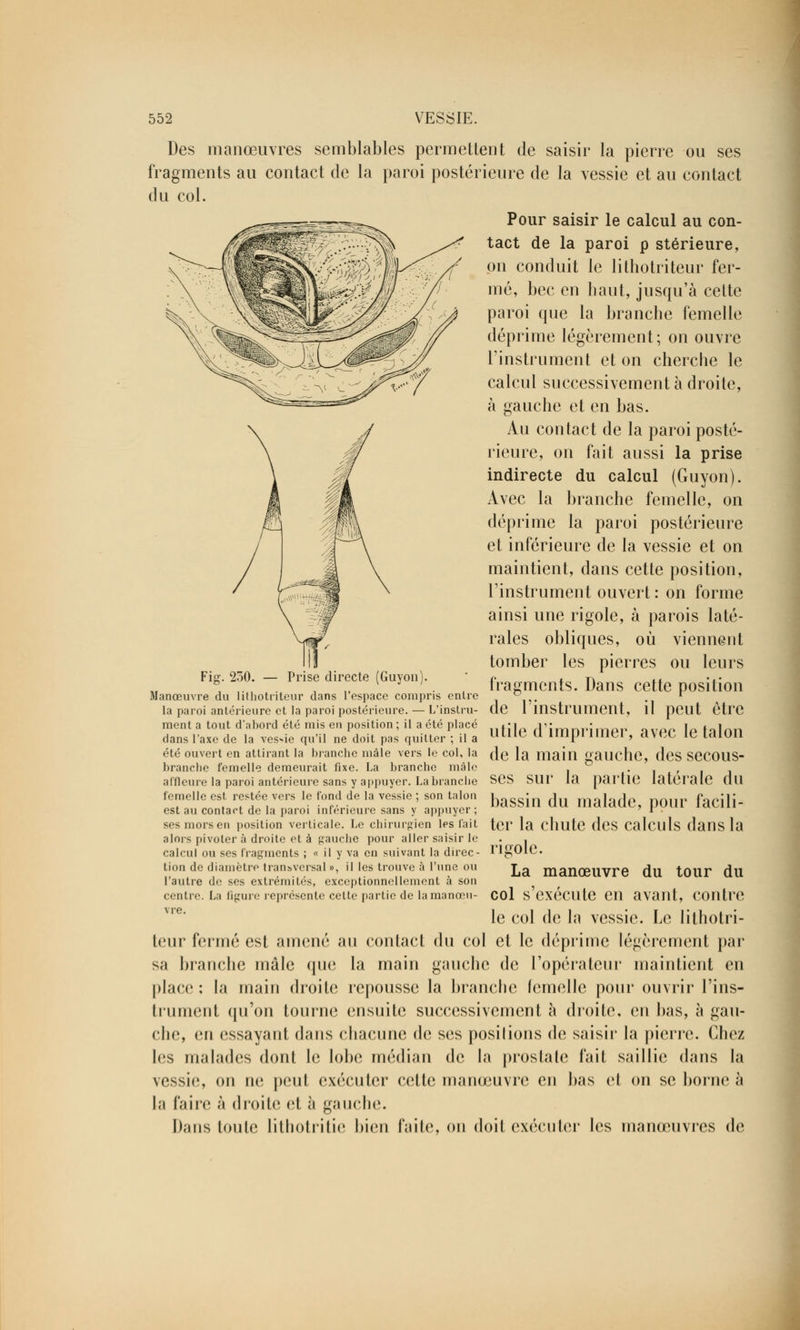 Des manœuvres semblables permettent de saisir la pierre ou ses fragments au contact de la paroi postérieure de la vessie et au contact du col. Pour saisir le calcul au con- tact de la paroi p stérieure, on conduit le lithotriteur fer- mé, bec en haut, jusqu'à cette paroi que la branche femelle déprime légèrement; on ouvre l'instrument et on cherche le calcul successivement à droite, à gauche et en bas. Au contact de la paroi posté- rieure, on fait aussi la prise indirecte du calcul (Guyon). Avec la branche femelle, on déprime la paroi postérieure et inférieure de la vessie et on maintient, dans cette position, l'instrument ouvert : on forme ainsi une rigole, à parois laté- rales obliques, où viennent tomber les pierres ou leurs fragments. Dans cette position de l'instrument, il peut être utile d'imprimer, avec le talon de la main gauche, des secous- Fig. 250. — Prise directe (Guyon). Manœuvre du lithotriteur dans l'espace compris entre la paroi antérieure et la paroi postérieure. — L'instru- ment a tout d'abord été mis en position ; il a été placé clans l'axe de la ves-ie qu'il ne doit pas quitter ; il a été ouvert en attirant la branche mâle vers le col, la branche femelle demeurait fixe. La branche mâle affleure la paroi antérieure sans y appuyer. La branche SCS SUC la partie latérale dll bassin du malade, pour facili- ter la chute des calculs dans la femelle est restée vers le fond de la vessie ; son talon est au contact de la paroi inférieure sans y appuyer ; ses mors en position verticale. Le chirurgien les fait alors pivoter à droite et à gauche pour aller saisir le calcul ou ses fragments ; « il y va en suivant la direc- tion de diamètre transversal », il les trouve à l'une ou l'autre de ses extrémités, exceptionnellement à son centre. La figure représente cette partie de la manœu- vre. 'igole. La manœuvre du tour du col s'exécute en avant, contre le col de la vessie. Le lithotri- teur fermé est amené au contact du col et le déprime légèrement par sa branche mâle que la main gauche de l'opérateur maintient en place: la main droite repousse la branche femelle pour ouvrir l'ins- trument qu'on tourne ensuite successivement à droite, en bas, à gau- che, en essayant dans chacune de ses positions de saisir la pierre. Chez les malades dont le lobe médian de la prostate fait saillie dans la vessie, on ne peut exécuter cette manœuvre en bas el on se borne à l,i faire à droite et h gauche. Dans toute lithotritie bien faite, on doit exécuter les manœuvres de