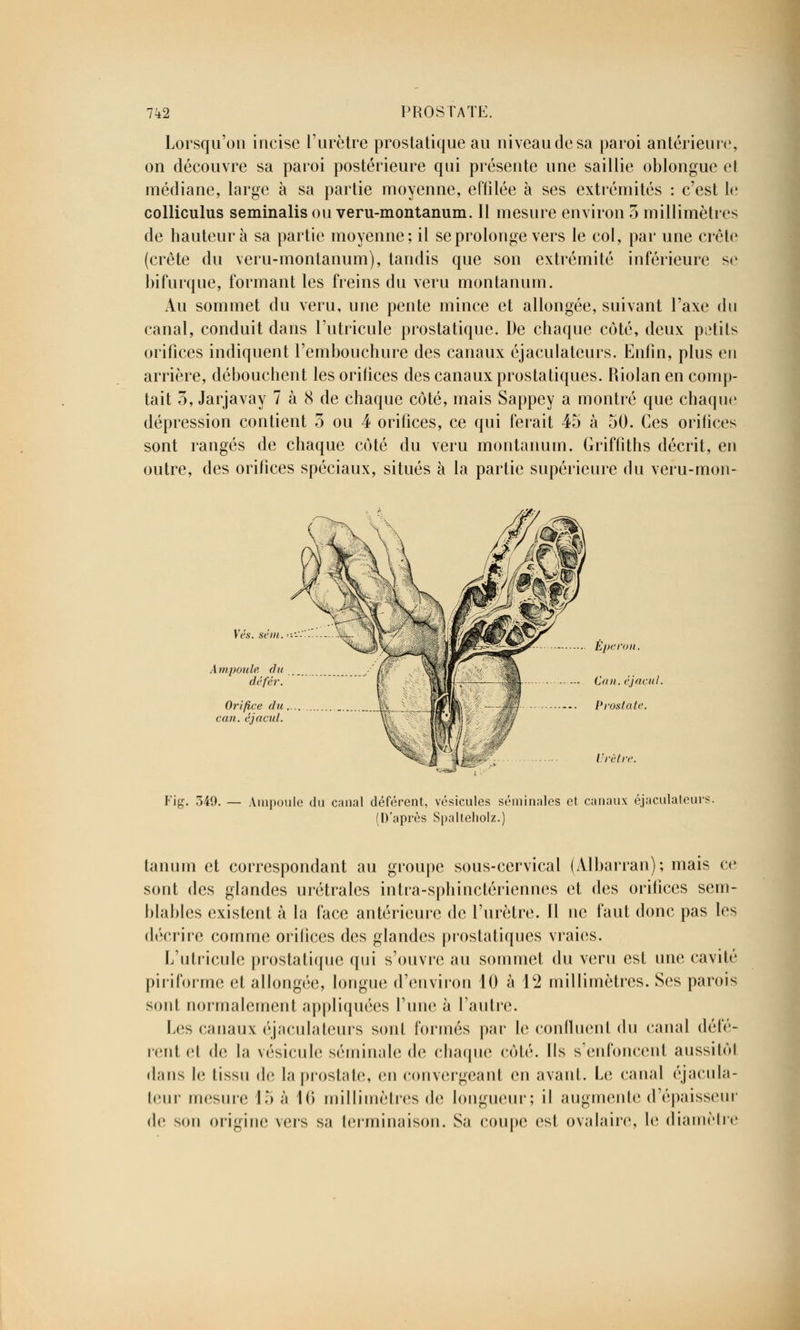 Lorsqu'on incise l'urètre prostatique au niveau de sa paroi antérieure, on découvre sa paroi postérieure qui présente une saillie oblongue et médiane, large à sa partie moyenne, effilée à ses extrémités : c'est le colliculus seminalis ou veru-montanum. 11 mesure environ 5 millimètres de hauteur à sa partie moyenne; il se prolonge vers le col, par une crête (crête du veru-montanum), tandis que son extrémité inférieure se bifurque, formant les freins du veru montanum. Au sommet du veru, une pente mince et allongée, suivant l'axe du canal, conduit dans Putricule prostatique. De chaque côté, deux petits orifices indiquent l'embouchure des canaux éjaculateurs. Enfin, plus en arrière, débouchent les orifices des canaux prostatiques. Riolan en comp- tait 3, Jarjavay 7 à 8 de chaque côté, mais Sappey a montré que chaque dépression contient 5 ou 4 orifices, ce qui ferait 45 à 50. Ces orifices sont rangés de chaque côté du veru montanum. Griffiths décrit, en outre, des orifices spéciaux, situés à la partie supérieure du veru-mon- Vés. f>âii. Éperon. Ampoule du /0 •■'^Xlff ■' Vm défér. ' fi >'v IflflfT-—— -iB Cou. éjacul. Orifice du |S. ' «fnftV: ■ —Mil Prostate. citn. éjacul. V flifojn ' V - S W il m % Pi ^%_ J \tJ—'.i Urètre. Fig. 549. — Ampoule du canal déférent, vésicules séminales cl canaux éjaculateurs. (D'après Spalteholz.) tanum et correspondant au groupe sous-cervical (Albarran); mais ce sont des glandes urétrales intra-sphinclériennes et des orifices sem- blables existent à la face antérieure de l'urètre. 11 ne faut donc pas les décrire comme orifices des glandes prostatiques vraies. L'utricule prostatique qui s'ouvre au sommet du veru est une cavité pi ri forme et allongée, longue d'environ 10 à 12 millimètres. Ses parois sont normalement appliquées l'une à l'autre. Les canaux éjaculateurs sonl formés par le confluenl du canal défé- rent et d(î la vésicule séminale de chaque côté. Ils s'enfoncent aussilùl dans le lissn de la prostate, en convergeant en avant. Le canal éjacula- teur mesure 15 à 16 millimètres de longueur; il augmente d'épaisseur de son origine vers sa terminaison. Sa coupe esl ovalaire, le diamètre