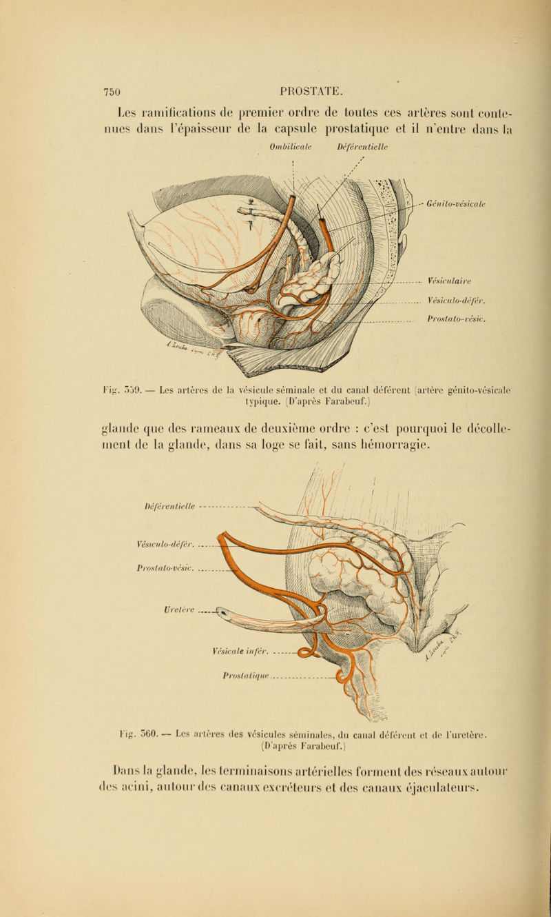 Les ramifications de premier ordre de toutes ces artères sont conte- nues dans l'épaisseur de la capsule prostatique et il n'entre dans la Ombilicale Déférentielle ^==lS LJ---' Génilo-vésicale ... Vésiculaire .. Vésiculo-dèf'ér. Prostato-vésic. Fig. 359. — Les artères de la vésicule séminale et du canal déférent (artère génito-vésicale typique. (D'après Farabeuf.) glande que des rameaux de deuxième ordre : c'est pourquoi le décolle- ment de la glande, dans sa loge se fait, sans hémorragie. Déferai lie lie Véstculo-défér. ... Prostato-vésic. ... Uretère .... Vésicale infér. . Prostatique.. I ig. TitiO.— Les artères «les vésicules séminales, du canal déférent <i de l'uretère. [D'après Farabeuf.] Dans la glande. 1rs terminaisons artérielles formenl des réseaux autour des acini, autour des canaux excréteurs et des canaux éjaculateurs.