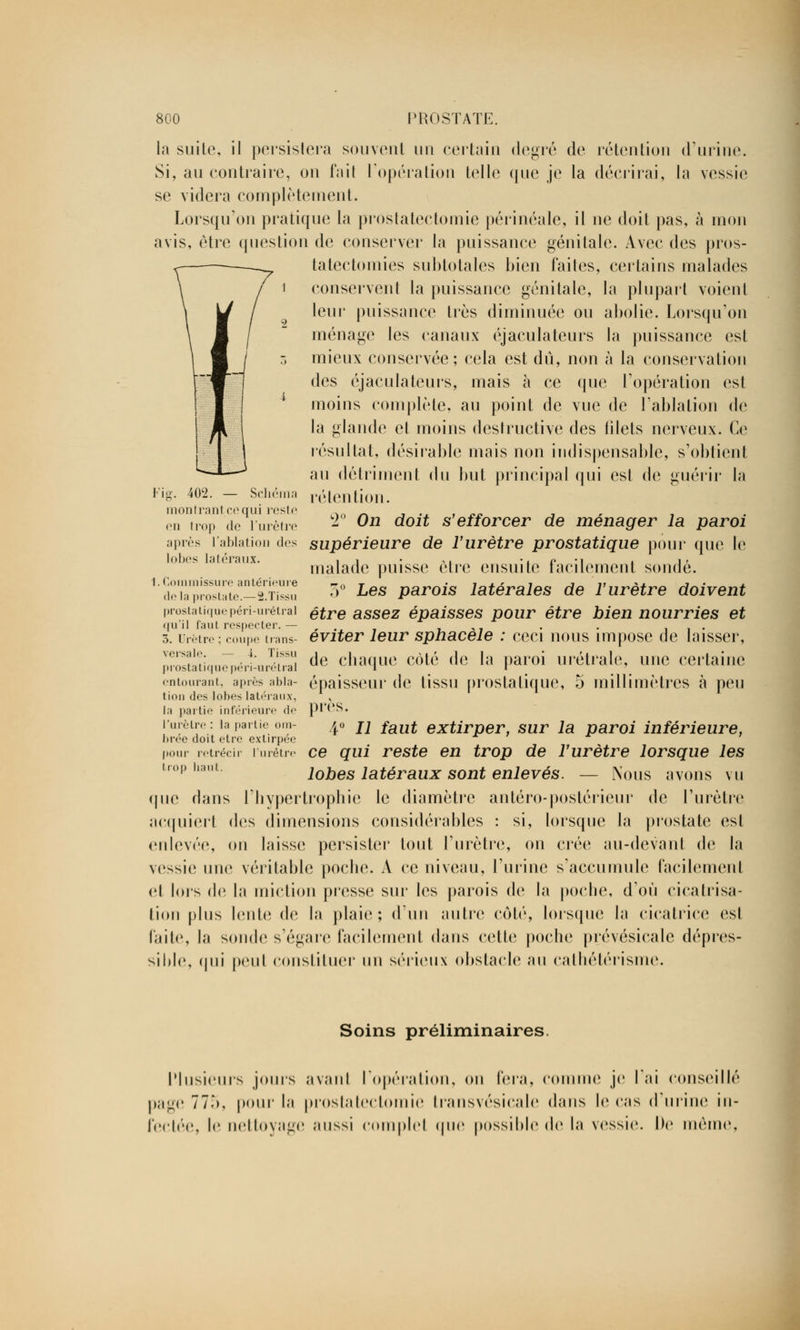 la suite, il persistera souvent un certain i\e^\v de rétention d'urine. Si, au contraire, on fait l'opération telle que je la décrirai, la vessie se videra complètement. Lorsqu'on pratique la prostatectomie périnéale, il ne doit pas, à mon avis, être question de conserver la puissance génitale. Avec des pros- tatectomies subtotales bien faites, certains malades conservent la puissance génitale, la plupart voient leur puissance très diminuée ou abolie. Lorsqu'on ménage les canaux éjaculateurs la puissance est mieux conservée ; cela est dû, non à la conservation des éjaculateurs, mais à ce que l'opération est moins complète, au point de vue de l'ablation de la glande et moins destructive des blets nerveux. Ce résultat, désirable mais non indispensable, s'obtient au détriment du but principal qui est de guérir la rétention. 2° On doit s'efforcer de ménager la paroi supérieure de l'urètre prostatique pour que le malade puisse être ensuite facilement sondé. 3° Les parois latérales de l'urètre doivent prostatiquepéri-urétrai être assez épaisses pour être bien nourries et qu'il faut respecter. — „ . . . . éviter leur sphacele : ceci nous impose de laisser, Fig. 402. — Seliéma montrant ce qui reste en trop de l'urètre après l'ablation dos lohos latéraux. 1. Commissure antérieure delà prostate.— 2.Tissu de chaque côté de la paroi urétrale, une certaine épaisseur de tissu prostatique, 5 millimètres à peu près. 4° Il faut extirper, sur la paroi inférieure, 3. Urètre : coupe trans- versale. — i. Tissu prostatique péri-urétral entourant, après abla- tion des lobes latéraux, la partie inférieure de l'urètre : la partie om- brée doit être extirpée pour rétréci, l'urètre ce qui reste en trop de l'urètre lorsque les lobes latéraux sont enlevés. — Nous avons vu que dans l'hypertrophie le diamètre antéro-postérieur de l'urètre acquiert des dimensions considérables : si, lorsque la prostate est enlevée, on laisse persister tout l'urètre, on crée au-devanl de la vessie une véritable poche. A ce niveau, l'urine s'accumule facilement et lois de la miction presse sur les parois de la poche, d'où cicatrisa- tion pi us lente de la plaie; d'un autre coté, lorsque la cicatrice csl faite, la sonde s'égare facilement dans cette poche prévésicale dépres- sible, qui peut constituer un sérieux obstacle au cathétérisme. Soins préliminaires. Plusieurs jours avanl l'opération, on fera, comme je l'ai conseillé page 77Ô, pour la prostatectomie transvésicale dans le cas d'urine in- fectée, le nettoyage ;mssi complet que possible de la vessie. De même,