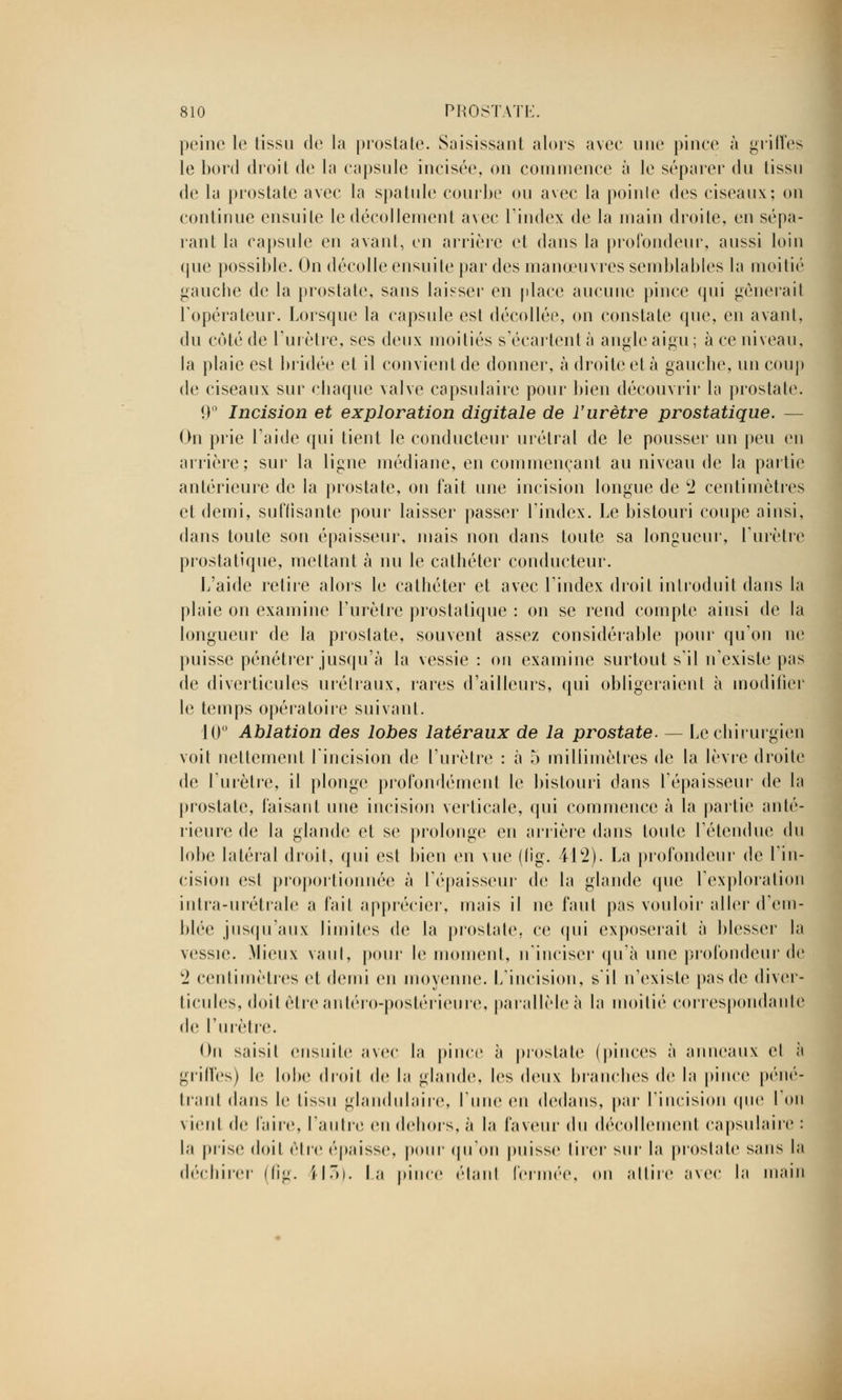 peine le tissu de la prostate. Saisissant alors avec une pince à griffes le bord droit de la capsule incisée, on commence à le séparer du tissu de la prostate avec la spatule courbe ou avec la pointe des ciseaux; on continue ensuite le décollement avec l'index de la main droite, en sépa- rant la capsule en avant, en arrière et dans la profondeur, aussi loin que possible. On décolle ensuite par des manœuvres semblables la moitié gauche de la prostate, sans laisser en place aucune pince qui gênerait l'opérateur. Lorsque la capsule est décollée, on constate que, en avant, du côté de l'urètre, ses deux moitiés s'écartent à angle aigu; à ce niveau, la plaie est bridée et il convient de donner, à droite et à gauche, un coup de ciseaux sur chaque valve capsulaire pour bien découvrir la prostate. 9° Incision et exploration digitale de l'urètre prostatique. — On prie l'aide qui tient le conducteur urétral de le pousser un peu en arrière; sur la ligne médiane, en commençant au niveau de la partie antérieure de la prostate, on fait une incision longue de c2 centimètres et demi, su (lisante pour laisser passer l'index. Le bistouri coupe ainsi, dans toute son épaisseur, mais non dans toute sa longueur, l'urètre prostatique, mettant à nu le cathéter conducteur. L'aide relire alors le cathéter et avec l'index droit introduit dans la plaie on examine l'urètre prostatique : on se rend compte ainsi de la longueur de la prostate, souvent assez considérable pour qu'on ne puisse pénétrer jusqu'à la vessie : on examine surtout s'il n'existe pas de diverticules urélraux, rares d'ailleurs, qui obligeraient à modifier le temps opératoire suivant. 10° Ablation des lobes latéraux de la prostate. — Le chirurgien voit nettement l'incision de l'urètre : à 5 millimètres de la lèvre droite de l'urètre, il plonge profondément le bistouri dans l'épaisseur de la prostate, faisant une incision verticale, qui commence à la partie anté- rieure de la glande et se prolonge en arrière dans ton le l'étendue du lobe latéral droit, qui est bien en vue (fîg. 41*2). La profondeur de l'in- cision est proportionnée à l'épaisseur de la glande que l'exploration intra-urétrale a fait apprécier, mais il ne faut pas vouloir aller d'em- blée jusqu'aux limites de la prostate, ce qui exposerait à blesser la \cssie. Mieux vaut, pour le moment, n'inciser qu'à une profondeur de c2 centimètres et demi en moyenne. L'incision, s'il n'existe pas de diver- ticules, doit être antéro-poslérieure, parallèle à la moitié correspondante de l'urètre. On saisit ensuite avec la pince à prostate (pinces à anneaux et à cilles) le lobe droit de la glande, les deux blanches de la pince penc- hant dans le tissu glandulaire, lime en dedans, par l'incision (pie Ton vient de faire, l'autre en dehors, à la faveur du décollement capsulaire : la prise doit être épaisse, pour qu'on puisse tirer sur la prostate sans la déchirer (fîg. H3). La pince étant fermée, on attire avec la main