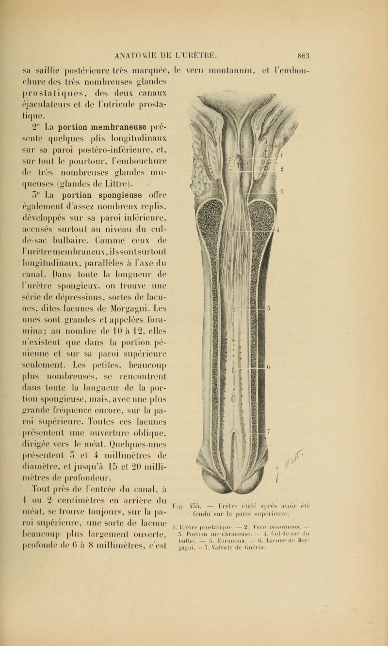 sa saillie postérieure très marquée chure des très nombreuses glandes prostatiques, des deux canaux éjaculateurs et de l'utricule prosta- tique. 2° La portion membraneuse pré- sente quelques plis longitudinaux sur sa paroi postéro-inférieure, et, sur tout le pourtour, l'embouchure de très nombreuses glandes mu- queuses (glandes de Littre). 3° La portion spongieuse offre également d'assez nombreux replis, développés sur sa paroi intérieure, accusés surtout au niveau du cul- de-sac bulbaire. Comme ceux de lu rètre membraneux, ils sont surtout longitudinaux, parallèles à Taxe du canal. Dans toute la longueur de l'urètre spongieux, on trouve une série de dépressions, sortes de lacu- nes, dites lacunes de Morgagni. Les unes sont grandes et appelées lbra- mina; au nombre de 10 à 12, elles n'existent que dans la portion pé- nienne et sur sa paroi supérieure seulement. Les petites, beaucoup plus nombreuses, se rencontrent dans toute la longueur de la por- tion spongieuse, mais, avec une plus grande fréquence encore, sur la pa- roi supérieure. Toutes ces lacunes présentent une ouverture oblique, dirigée vers le méat. Quelques-unes présentent 3 et 4 millimètres de diamètre, et jusqu'à 15 et 20 milli- mètres de profondeur. Tout près de rentrée du canal, à I ou 2 cenlimètres en arrière du méat, se trouve toujours, sur la pa- roi supérieure, une sorte de lacune beaucoup plus largement ouverte, profonde de 6 à 8 millimètres, c'est ANATOMIE DE L'URETRE. 863 e veru montanum, et i'embou- 'ikIu Urèfre étalé ;i|> tir la paroi supé •es avo rieure. il' clé Urètre prostatique. —2. V r>. Portion me-nbraneuse bulbe. — 5. Foramina. — eairni. - 7. Valvule de Cuéi h montanum. — i. (lul-de-sac du Lacune de Mor-