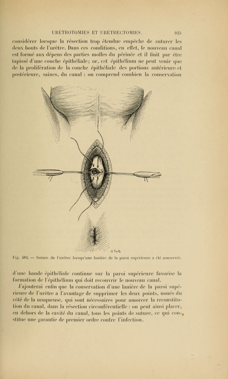 considérer lorsque la résection trop étendue empêche de suturer les deux bouts de l'urètre. Dans ces conditions, en effet, le nouveau canal est formé aux dépens des parties molles du périnée et il finit par être tapissé d'une couche épithéliale; or, cet épithélium ne peut venir que de la prolifération de la couche épithéliale des portions antérieure et postérieure, saines, du canal : on comprend combien la conservation 'iff. 484. H Tuai Suture de l'urètre lorsqu'une lanière de la paroi supérieure a été conservée d'une bande épithéliale continue sur la paroi supérieure favorise la formation de F épithélium qui doit recouvrir le nouveau canal. .l'ajouterai enfin que la conservation d'une lanière de la paroi supé- rieure de l'urètre a l'avantage de supprimer les deux points, noués du côté de la muqueuse, qui sont nécessaires pour amorcer la reconstitu- tion du canal, dans la résection cirronlerenlielle : on peut ainsi placer, en dehors de la cavité du canal, tous les points de suture, ce qui cou-, sliluc une garantie de premier ordre contre l'infection.
