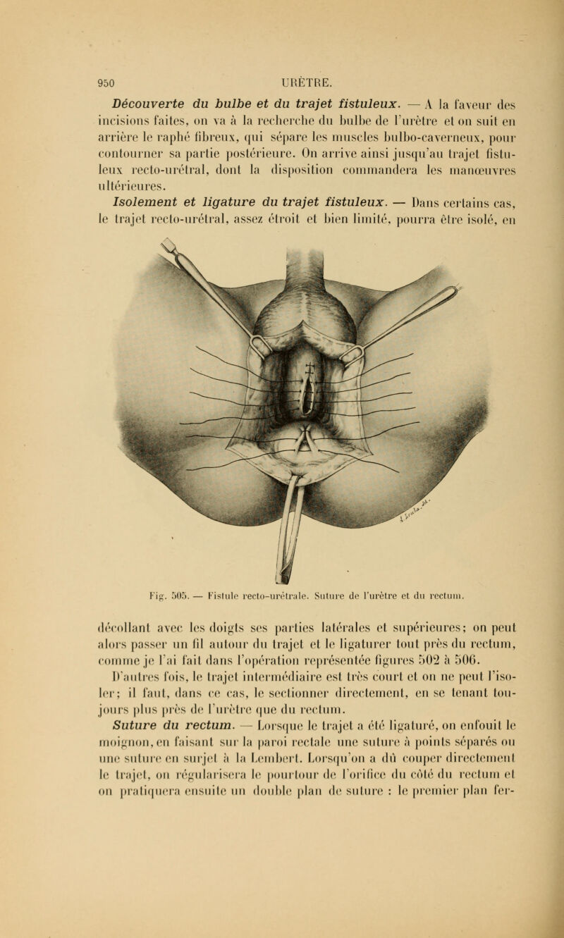 Découverte du bulbe et du trajet fistuleux. — A la faveur des incisions faites, on va à la recherche du bulbe de l'urètre et on suit en arrière le raphé fibreux, qui sépare les muscles bulbo-caverneux, pour contourner sa partie postérieure. On arrive ainsi jusqu'au trajet fistu- leux recto-urétral, dont la disposition commandera les manœuvres ultérieures. Isolement et ligature du trajet fistuleux. — Dans certains cas, le trajet recto-urétral, assez étroit et bien limité, pourra être isolé, en « Fip;. 505. — Fistule recto-urétraie. Suture de l'urètre et du rectum. décollant avec les doigts ses parties latérales et supérieures; on peut alors passer un fil autour du trajet et le ligaturer tout près du rectum, comme je l'ai fait dans l'opération représentée figures 502 à 500. D'autres lois, le trajet intermédiaire est très court et on ne peut l'iso- ler; il faut, dans ce cas, le sectionner directement, en se tenant tou- jours plus près de l'urètre que du rectum. Suture du rectum. — Lorsque le trajet a été ligaturé, on enfouit le moignon,eu faisant sur la paroi rectale une suture à points séparés ou une suture en surjel à la Lembert. Lorsqu'on a dû couper directement le trajet, on régularisera le pourtour do l'orifice du côté du rectum el on pratiquera ensuite un double plan de suture : le premier plan ïo\-