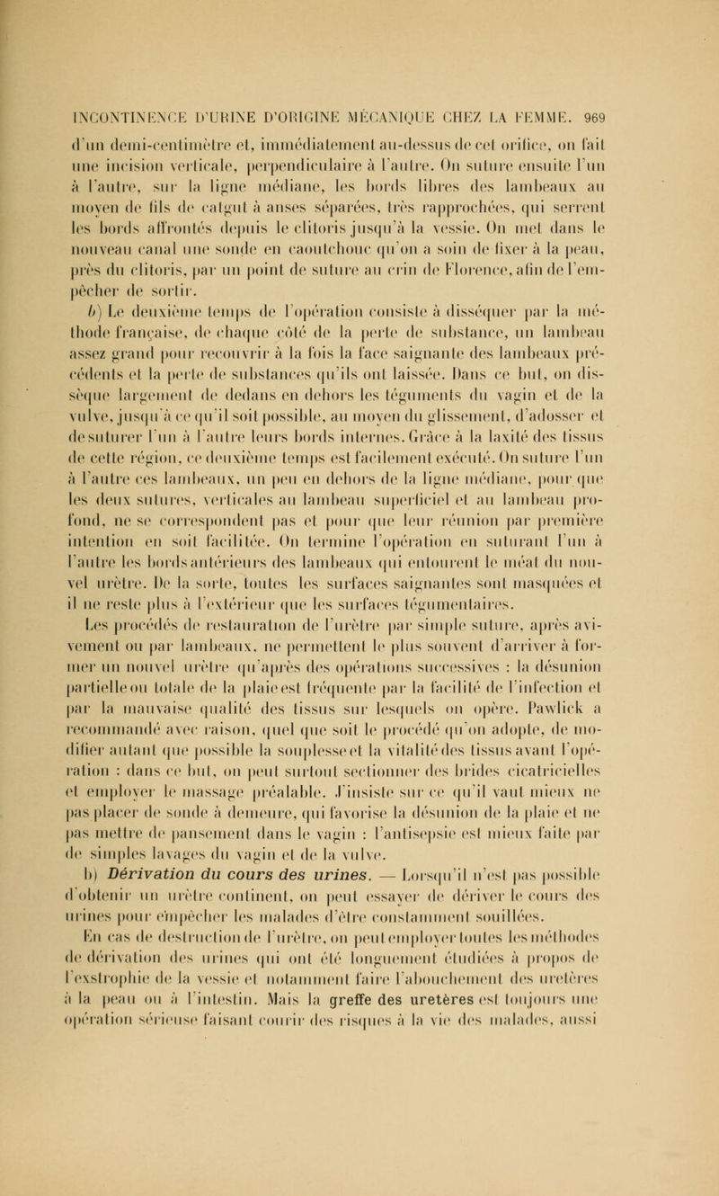 d'un demi-centimètre et, immédiatement au-dessus de cel orifice, on fait une incision verticale, perpendiculaire à l'autre. On suture ensuite l'un à l'autre, sur la ligne médiane, les bords libres des lambeaux au moyen de (ils de catgut à anses séparées, 1res rapprochées, qui serrent les bords affrontés depuis le clitoris jusqu'à la vessie. Ou met dans le nouveau canal une sonde en caoutchouc qu'on a soin de fixer à la peau, près du clitoris, par un point de suture au crin de Florence, afin de l'em- pêcher de sortir. b) Le deuxième temps de l'opération consiste à disséquer par la mé- thode française, de chaque coté de la perte de substance, un lambeau assez grand pour recouvrir à la fois la face saignante des lambeaux pré- cédents et la perte de substances qu'ils ont laissée. Dans ce but, on dis- sèque largement de dedans en dehors les téguments du vagin et de la vulve, jusqu'à ce qu'il soit possible, au moyeu du glissement, d'adosser et de suturer l'un à l'autre leurs bords internes. Grâce à la laxilé des tissus de cette région, ce deuxième temps est facilement exécuté. On suture l'un à l'autre ces lambeaux, un peu en dehors de la ligne médiane, pour que les deux sutures, verticales au lambeau superficiel et au lambeau pro- fond, ne se correspondent pas et pour que leur réunion par première intention en soit facilitée. On termine l'opération en suturant l'un à l'autre les bords antérieurs des lambeaux qui entourent le méat du nou- vel urètre. De la sorte, toutes les surfaces saignantes sont masquées et il ne reste plus à l'extérieur (pie les surfaces tégumentaires. Les procédés de restauration de l'urètre par simple suture1, après avi- vement ou par lambeaux, ne permettent le plus souvent d'arriver à for- mer un nouvel urètre qu'après (les opérations successives : la désunion partielle ou totale de la plaie est fréquente par la facilité de l'infection et par la mauvaise qualité des tissus sur lesquels on opère. Pawlick a recommandé avec raison, quel que soit le procédé qu'on adopte, de mo- difier autant que possible la souplesseet la vitalité des tissus avant l'opé- ration : dans ce but, on peut surtout sectionner des brides cicatricielles et employer le massage préalable. J'insiste sur ce qu'il vaut mieux ne pas placer de sonde à demeure, qui favorise la désunion de la plaie et ne pas mettre de pansement dans le vagin : l'antisepsie est mieux faite par de simples lavages du vagin et de la vulve. b) Dérivation du cours des urines. — Lorsqu'il n'est pas possible d'obtenir un urètre continent, on peut essayer de dériver le cours des urines pour empêcher les malades d'être constamment souillées. En cas de destruction de l'urètre, on peut employer toutes lesméthodes de dérivation des urines qui ont été longuement étudiées à propos de l'exstrophie de la vessie et notamment faire l'abouchement des uretères à la peau ou à l'intestin. Mais la greffe des uretères est toujours une opération sérieuse faisant courir des risques à la vie des malades, aussi