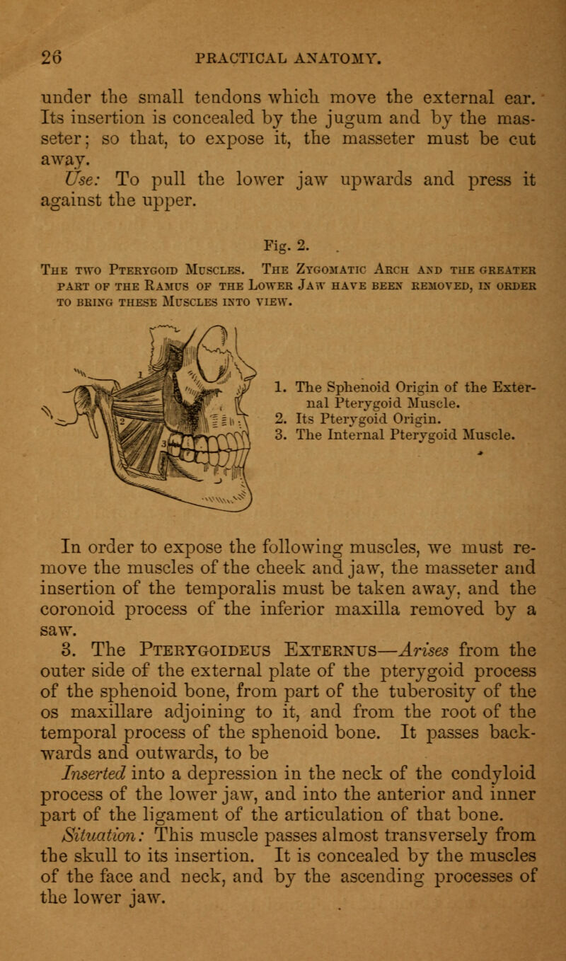 under the small tendons which, move the external ear. Its insertion is concealed by the jugum and by the mas- seter; so that, to expose it, the masseter must be cut away. Use: To pull the lower jaw upwards and press it against the upper. Fig. 2. . The two Pterygoid Muscles. The Zygomatic Arch and the greater part of the Ramus of the Lower Jaw have been removed, nr order to brixg these Muscles into view. 1. The Sphenoid Origin of the Exter- nal Pterygoid Muscle. 2. Its Pterygoid Origin. 3. The Internal Pterygoid Muscle. In order to expose the following muscles, we must re- move the muscles of the cheek and jaw, the masseter and insertion of the temporalis must be taken away, and the coronoid process of the inferior maxilla removed by a saw. 3. The Pterygoideus Exterxus—Arises from the outer side of the external plate of the pterygoid process of the sphenoid bone, from part of the tuberosity of the os maxillare adjoining to it, and from the root of the temporal process of the sphenoid bone. It passes back- wards and outwards, to be Inserted into a depression in the neck of the condyloid process of the lower jaw, and into the anterior and inner part of the ligament of the articulation of that bone. Situation: This muscle passes almost transversely from the skull to its insertion. It is concealed by the muscles of the face and neck, and by the ascending processes of the lower jaw.