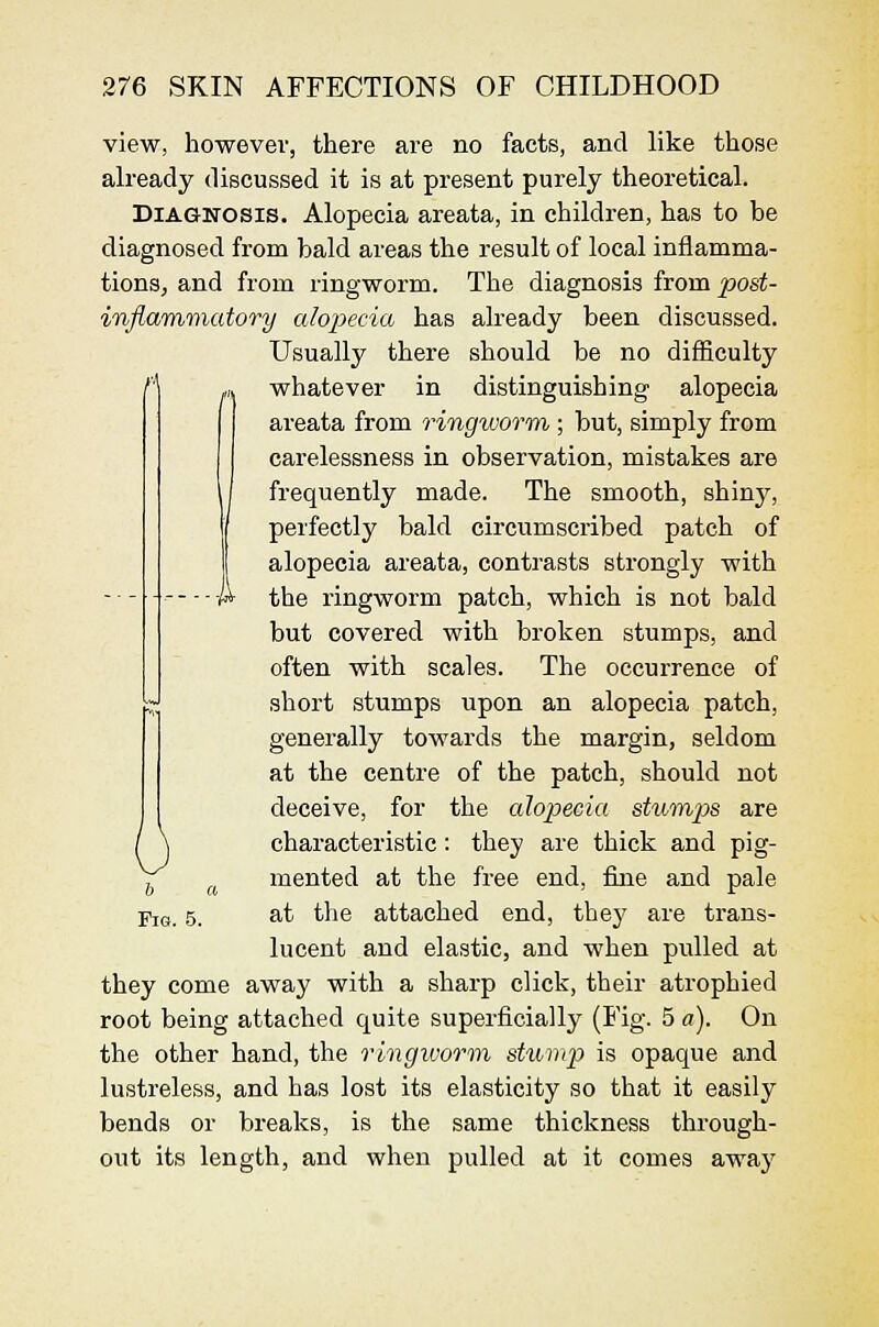 view, however, there are no facts, and like those already discussed it is at present purely theoretical. Diagnosis. Alopecia areata, in children, has to be diagnosed from bald areas the result of local inflamma- tions, and from ringworm. The diagnosis from post- inflammatory alopecia has already been discussed. Usually there should be no difficulty whatever in distinguishing alopecia areata from ringworm ; but, simply from carelessness in observation, mistakes are frequently made. The smooth, shinj^, perfectly bald circumscribed patch of alopecia areata, contrasts strongly with the ringworm patch, which is not bald but covered with broken stumps, and often with scales. The occurrence of short stumps upon an alopecia patch, generally towards the margin, seldom at the centre of the patch, should not deceive, for the alopecia stihinps are characteristic: they are thick and pig- mented at the free end, fine and pale at the attached end, they are trans- lucent and elastic, and when pulled at they come away with a sharp click, their atrophied root being attached quite superficially (Fig. 5 a). On the other hand, the ringworm stump is opaque and lustreless, and has lost its elasticity so that it easily bends or breaks, is the same thickness through- out its length, and when pulled at it comes away b c Fie. 5.