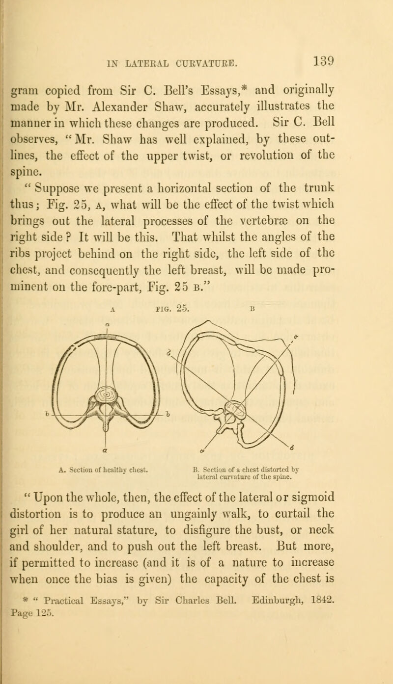 gram copied from Sir C. Bell's Essays,* and originally made by Mr. Alexander Shaw, accurately illustrates the manner in which these changes are produced. Sir C. Bell observes,  Mr. Shaw has well explained, by these out- lines, the effect of the upper twist, or revolution of the spine.  Suppose we present a horizontal section of the trunk thus; Fig. 25, a, what will be the effect of the twist which brings out the lateral processes of the vertebrae on the right side ? It will be this. That whilst the angles of the ribs project behind on the right side, the left side of the chest, and consequently the left breast, will be made pro- minent on the fore-part, Fig. 25 b. A FIG. 25. B A. Section of healthy chest. B. Section of a chest distorted hy lateral curvature of the spine.  Upon the whole, then, the effect of the lateral or sigmoid distortion is to produce an ungainly walk, to curtail the girl of her natural stature, to disfigure the bust, or neck and shoulder, and to push out the left breast. But more, if permitted to increase (and it is of a nature to increase when once the bias is given) the capacity of the chest is Edinburgh, 1842. *  Practical Essays, by Sir Charles Bell Page 125.