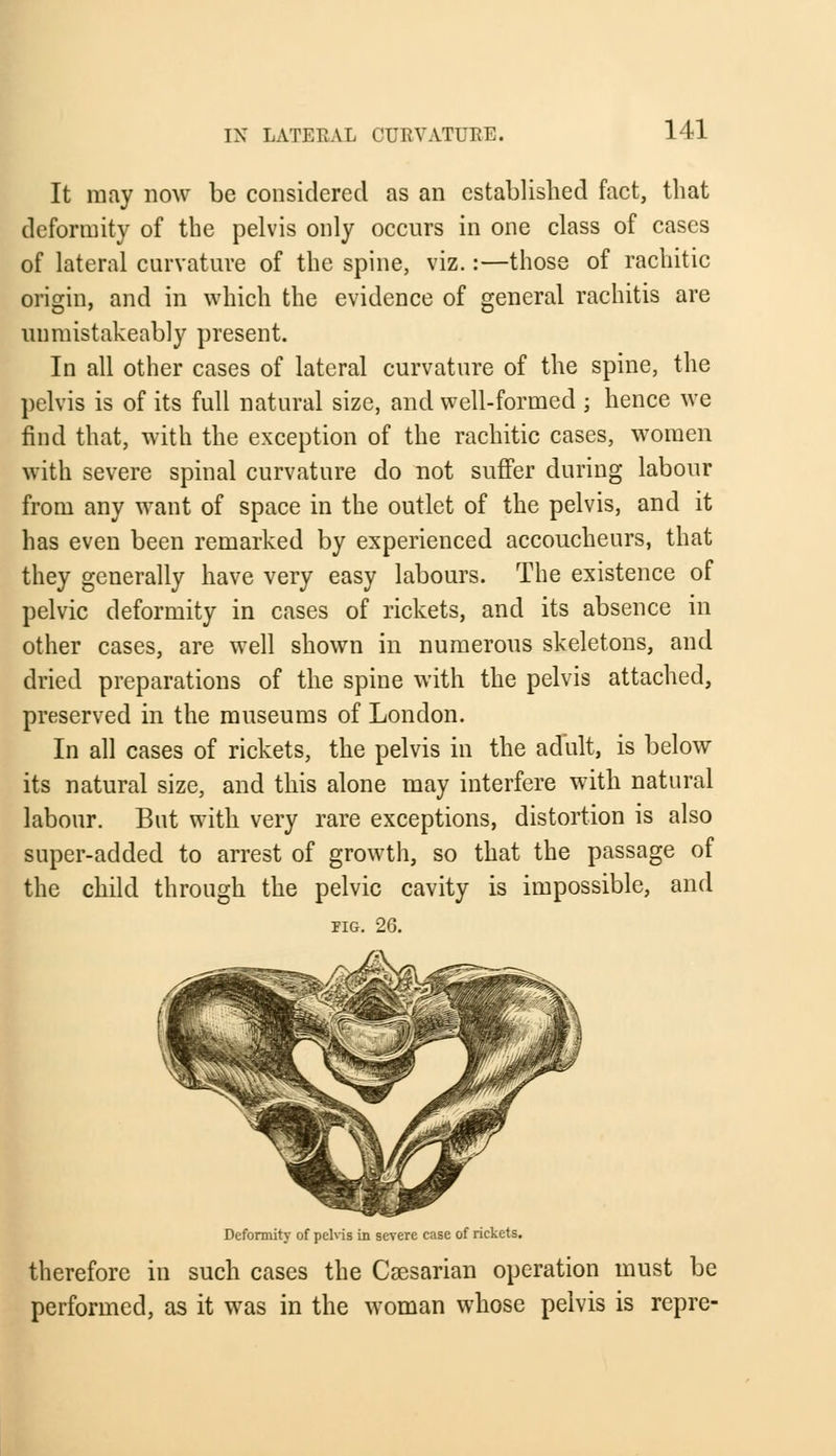 It may now be considered as an established fact, that deformity of the pelvis only occurs in one class of cases of lateral curvature of the spine, viz.:—those of rachitic origin, and in which the evidence of general rachitis are unmistakeably present. In all other cases of lateral curvature of the spine, the pelvis is of its full natural size, and well-formed ; hence we find that, with the exception of the rachitic cases, women with severe spinal curvature do not suffer during labour from any want of space in the outlet of the pelvis, and it has even been remarked by experienced accoucheurs, that they generally have very easy labours. The existence of pelvic deformity in cases of rickets, and its absence in other cases, are well shown in numerous skeletons, and dried preparations of the spine with the pelvis attached, preserved in the museums of London. In all cases of rickets, the pelvis in the adult, is below its natural size, and this alone may interfere with natural labour. But with very rare exceptions, distortion is also super-added to arrest of growth, so that the passage of the child through the pelvic cavity is impossible, and pig. 26. Deformity of pelns in severe case of rickets. therefore in such cases the Caesarian operation must be performed, as it was in the woman whose pelvis is repre-